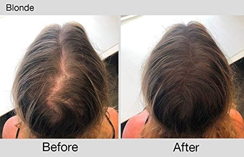Joan Rivers Great Hair Day Root Touch Up Powder Duo, Blonde - 2 Count Fill-in Powder for Thicker, Fuller Hair