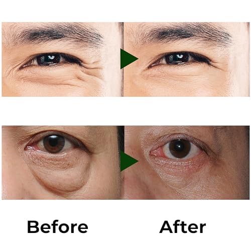 Abera Eye Roller Serum For Men - Eye Bags, Dark Circles & Puffiness Treatment - Mint Essence With Vitamin C & Peptides 0.34 Fl O