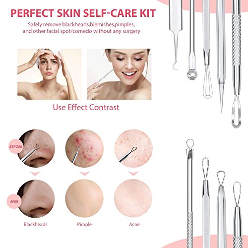 JPNK 6 PCS Blackhead Remover Comedones Extractor Acne Removal Kit for Blemish, Whitehead Popping, Zit Removing for Nose Face Too