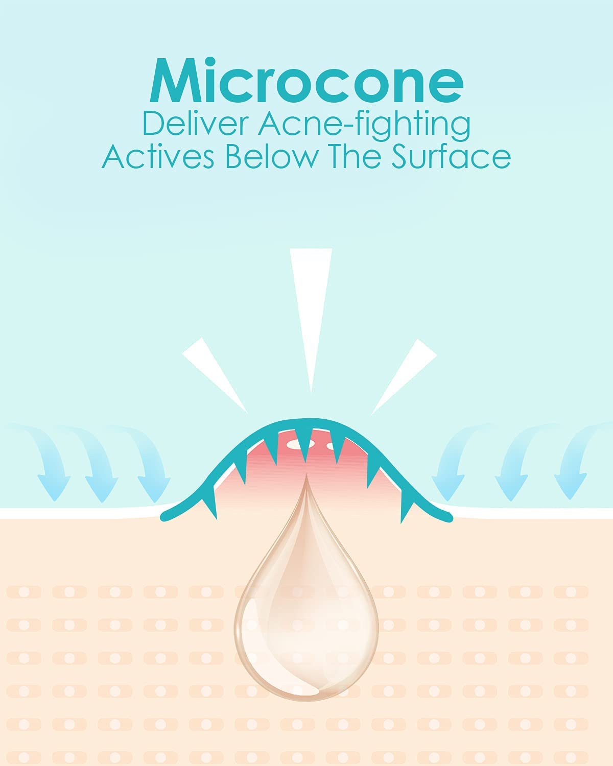 +1Herolabs Microdart Acne Patch - Hyaluronate, Salicylic Acid, Vitamin C, Microdart Pimple Patch For Deep, Early Stage And Hidde