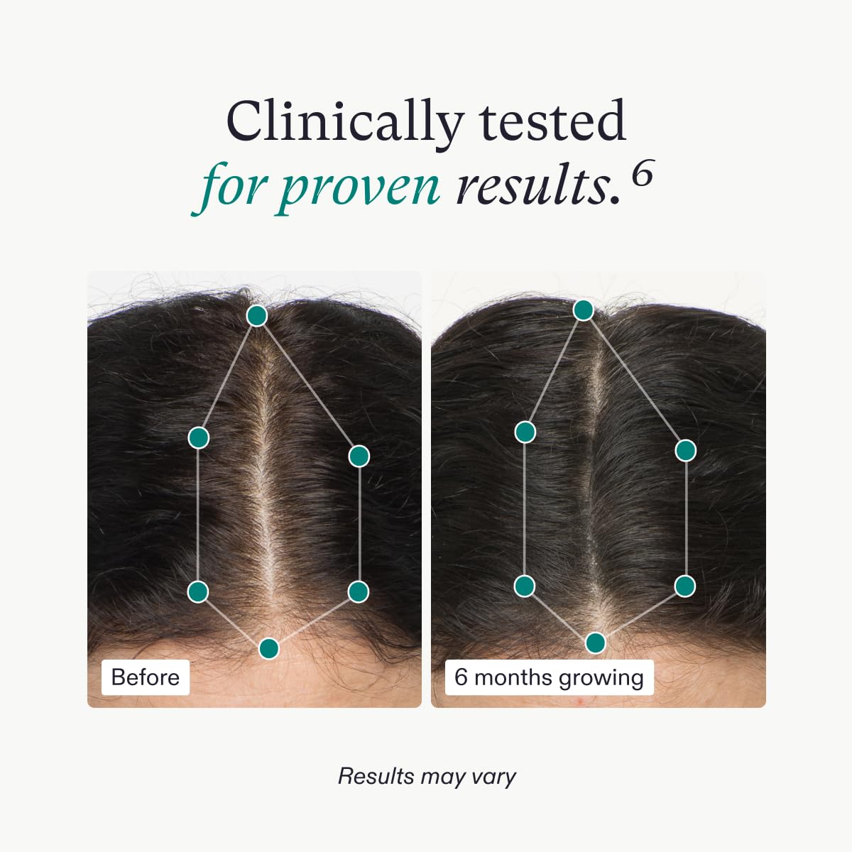 Nutrafol Women'S Hair Growth Supplements, Ages 18-44, Clinically Proven For Visibly Thicker And Stronger Hair, Dermatologist Rec