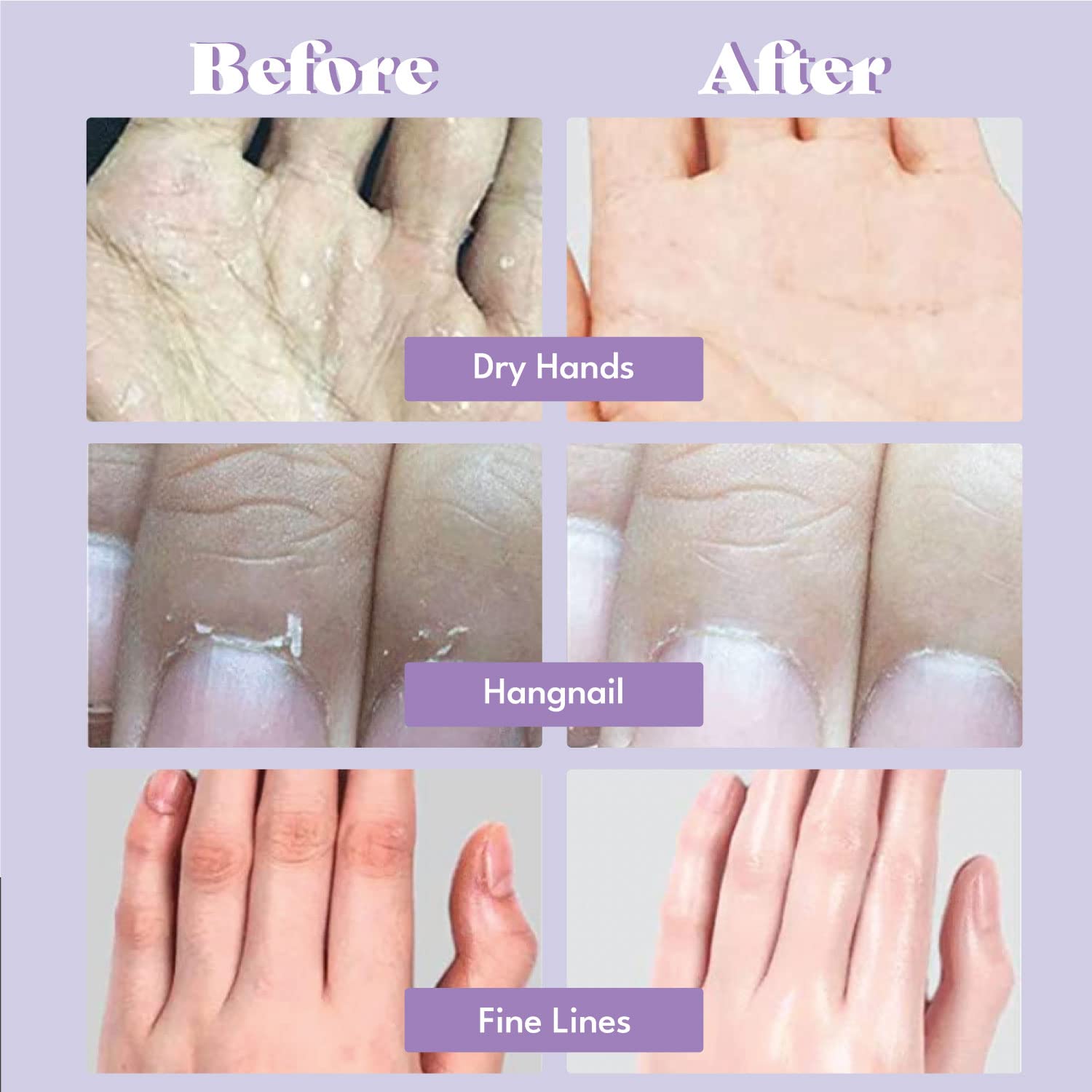 Toi:L Extra Silky Hand Mask 5 Pairs, Moisturizing Gloves For Dry Hands, Premium Hand Spa Treatment, Moisturizing, Brightening An