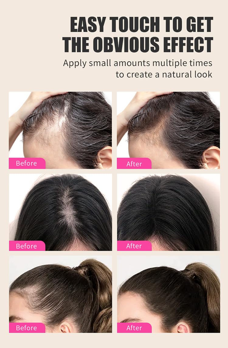 Velo Hairline Powder - Instantly Conceals Hair Loss And Gray Areas, Root Touch Up For Women & Men, Hair Fibers For Thinning Hair
