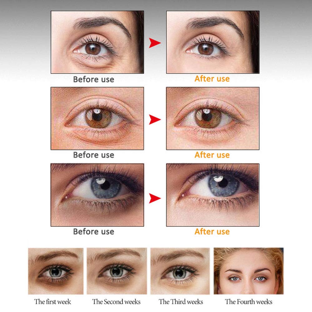 Miescher Eye Peptide Serum Eye Massage Roller Nourishing Relieve Loose Eye Bags Dark Circles Eye Skin Care Under Eye Cream For F