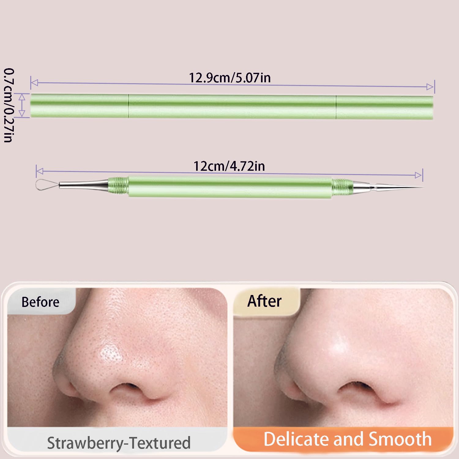 2-In-1 Professional Stainless Steel Acne Removal Needle, Whitehead & Blackhead Remover Tool, Pimples Comedone Extractor Removal