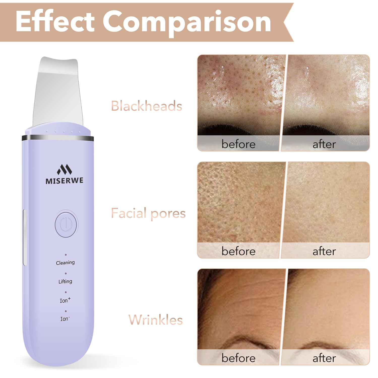 Skin Scrubber Face Skin Spatula Facial Scrubber Spatula For Deep Cleansing Blackhead Remover Pore Cleaner With 4 Modes (Purple)