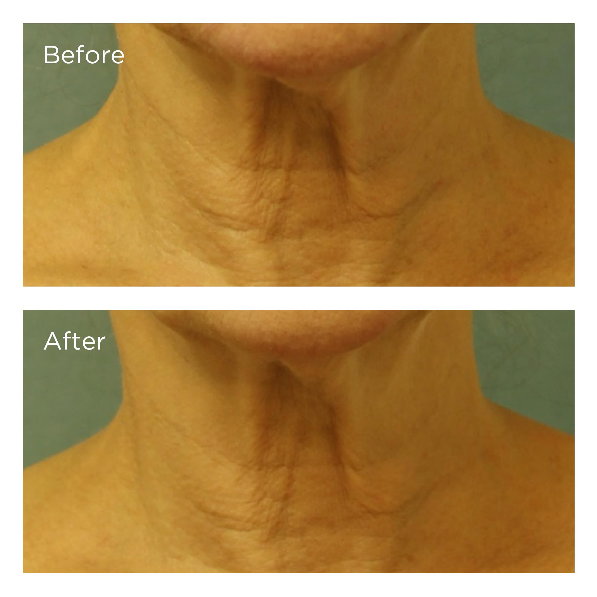 Perricone Md By Perricone Md