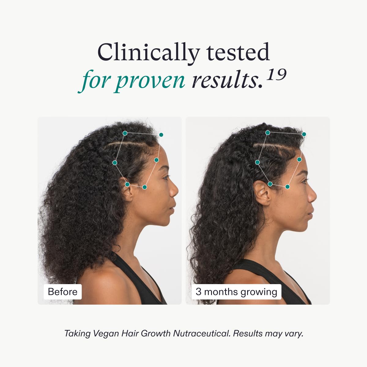 Nutrafol Women'S Hair Growth Supplements And Hair Serum, Women 18-44 Years Old, Clinically Tested For Visibly Thicker, Stronger