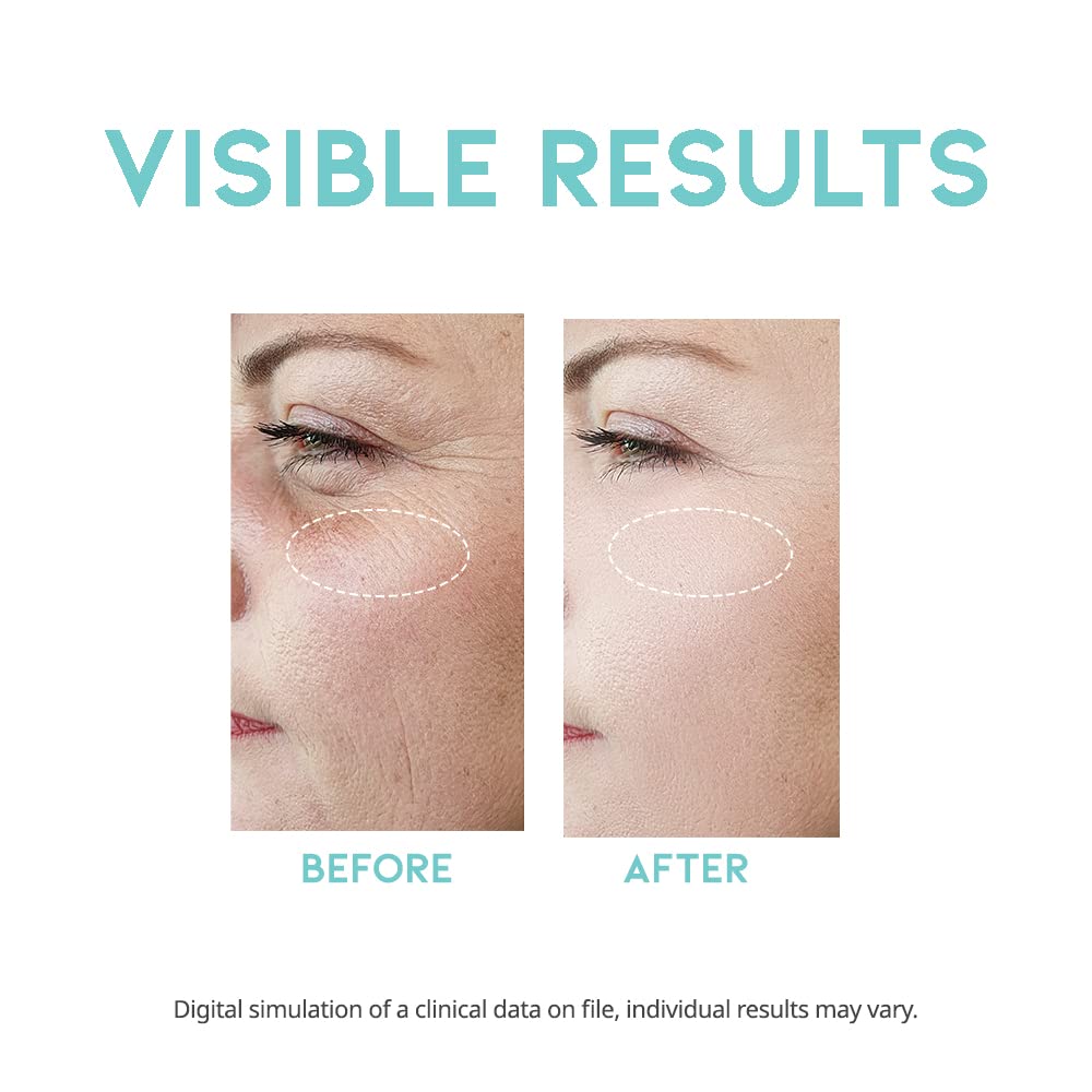 #Ootd Retinol Serum For Face Anti Aging [1.69 Fl Oz]: Korean Retinol Serum For Face, Vitamin A Serum, Face Serum For Elasticity,