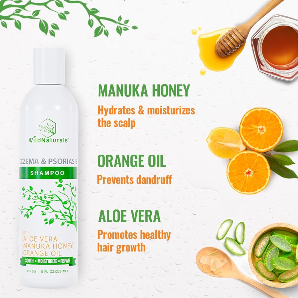 Psoriasis Shampoo For Dry Scalp Care - Anti Dandruff - Gentle Hydrating Shampoo For Itchy Scalp Treatment