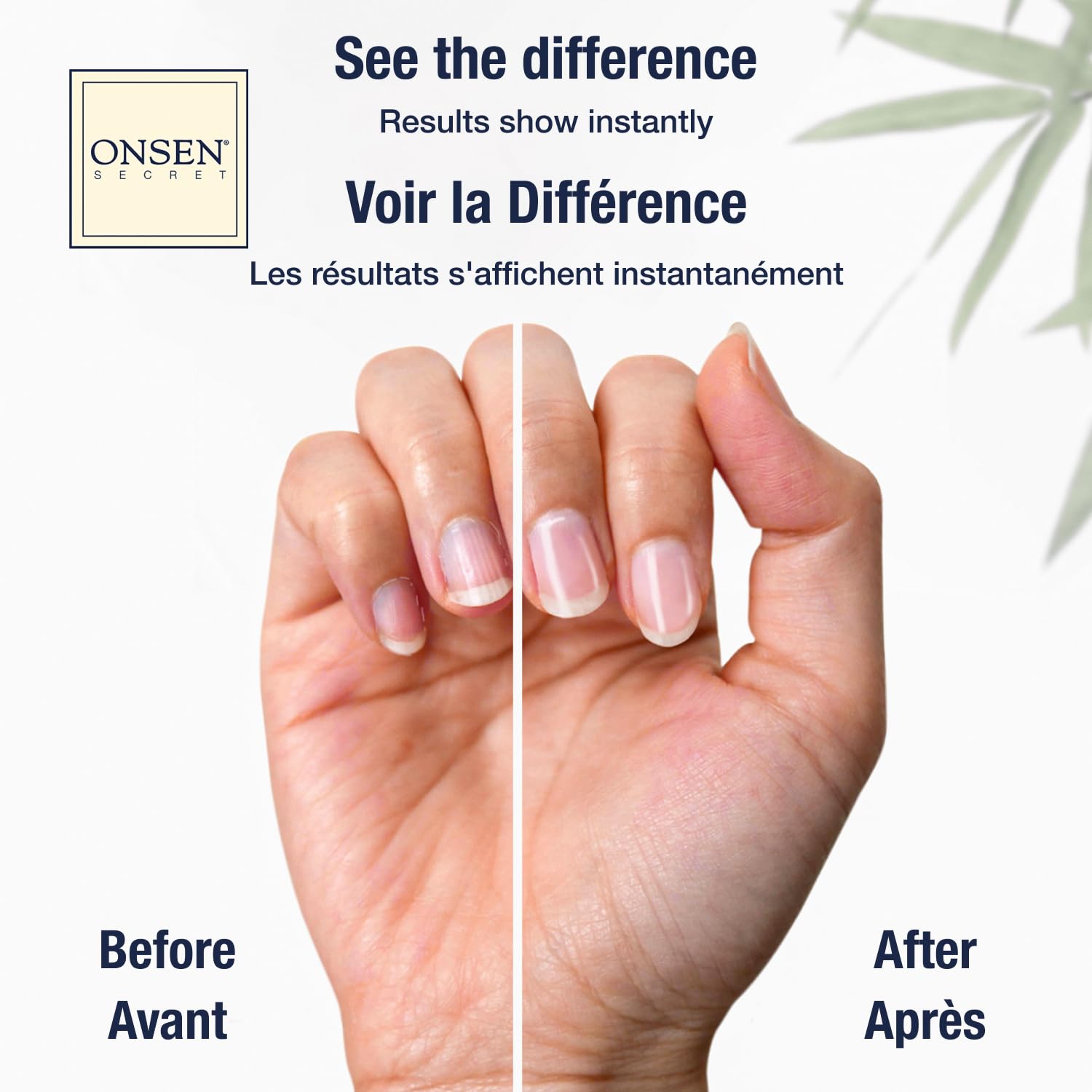 Onsen Cuticle Cream w/Nail Cuticle Oil | Cuticle Softener with Japanese Natural Healing Minerals | Nail Care Serum to Soothe, Re