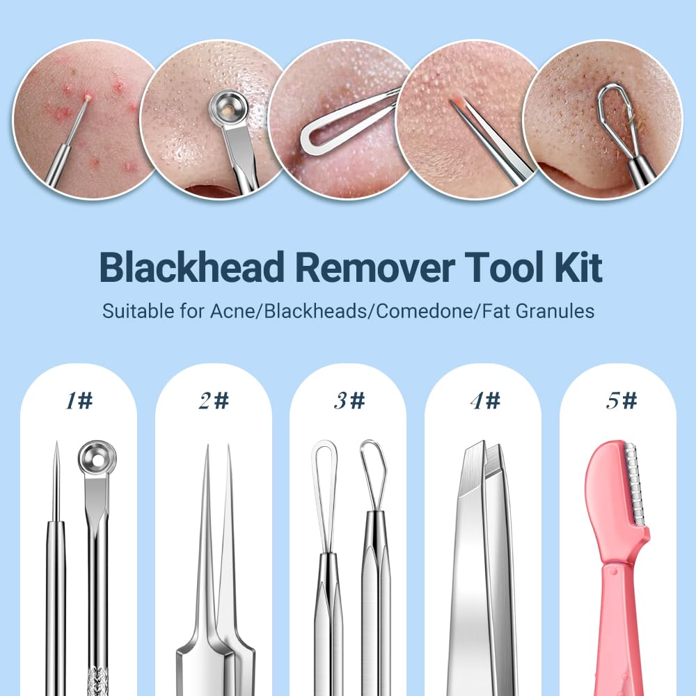 Tsmaddts Blackhead Remover Tools, Ingrown Hair Tweezers, Pimple Popper Tool Kit, Blackhead Extractor, Eyebrows Tweezers For Wome