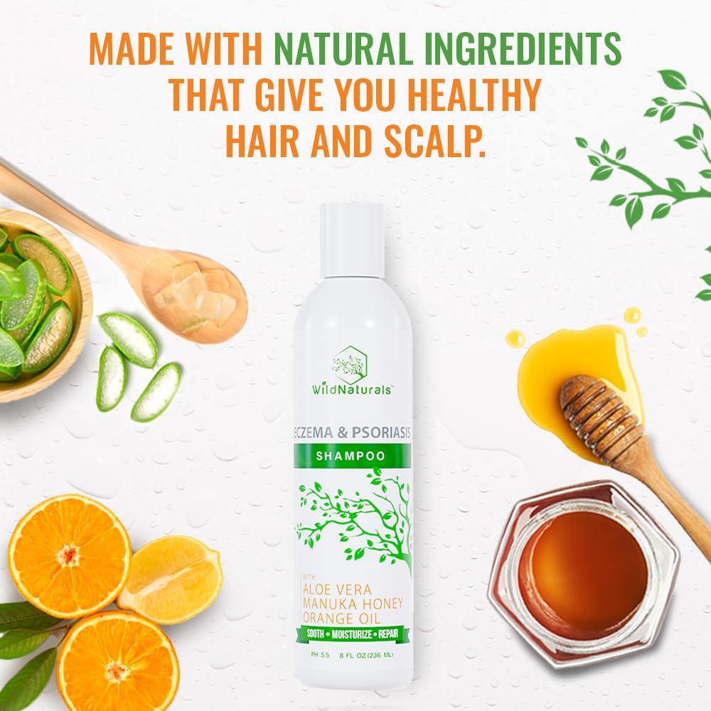 Psoriasis Shampoo For Dry Scalp Care - Anti Dandruff - Gentle Hydrating Shampoo For Itchy Scalp Treatment