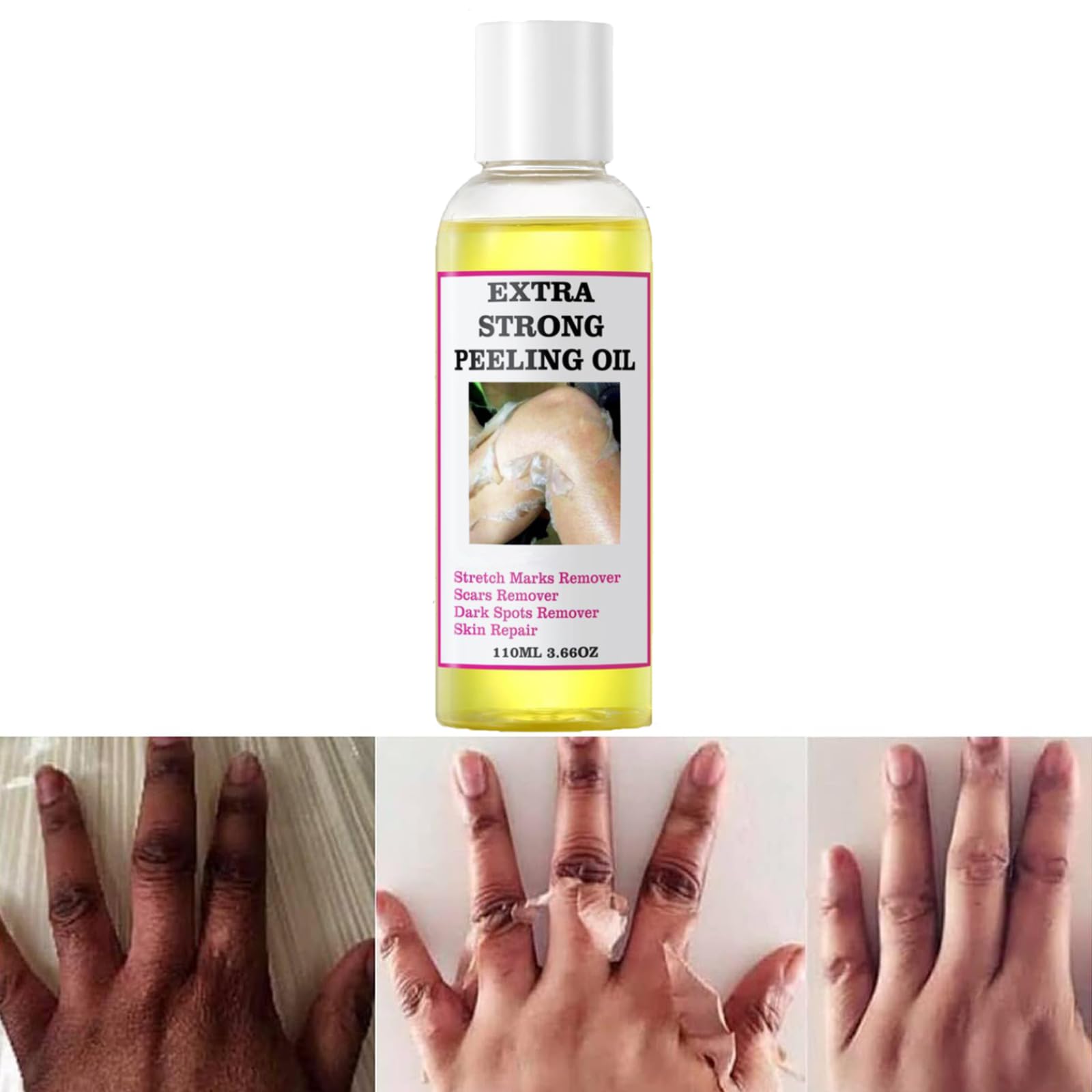 Generic Peeling Oil, Extra Strong Peeling Oil, Yellow Peeling Oil for Dark Skin, Exfoliating Peeling Solution for Body, Hand, Fe