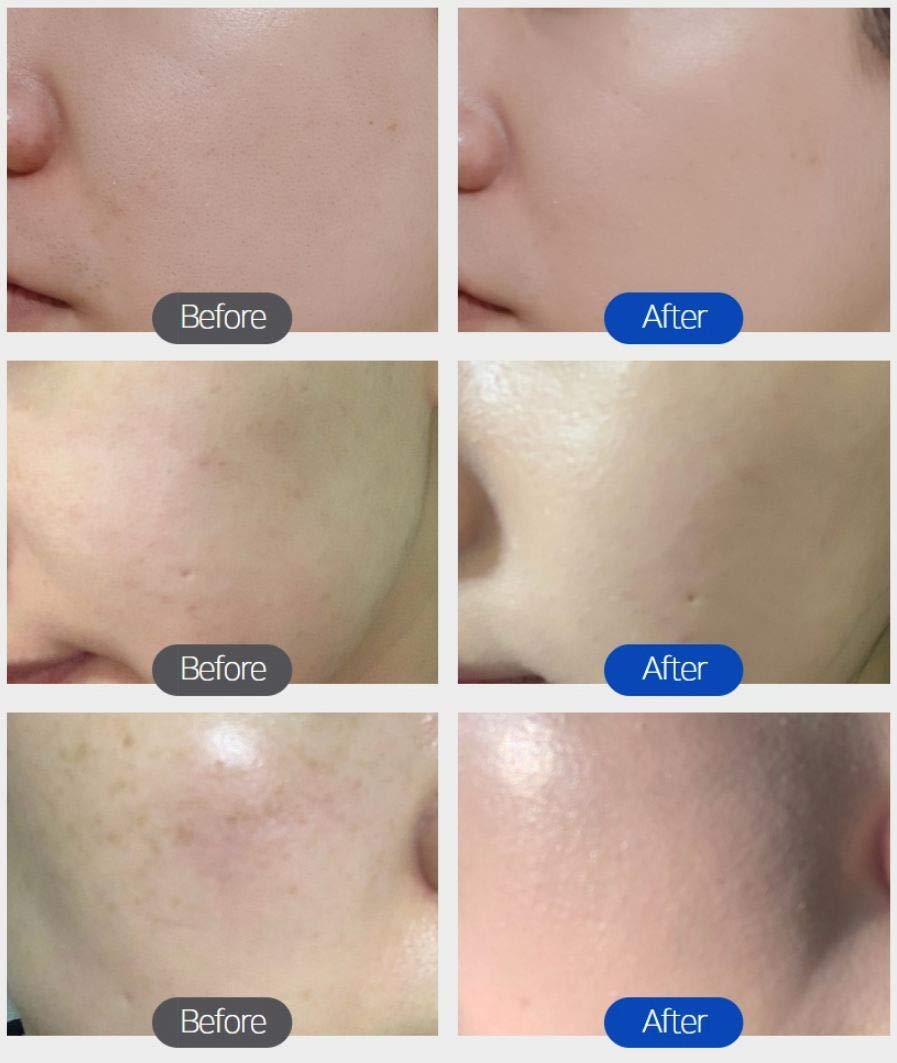 Troiareuke Aesthetic Bb Cream H+ Formula Spf50+ Pa+++, Lightweight Blemish Balm, Tinted Moisturizer With Medium Coverage, Lastin