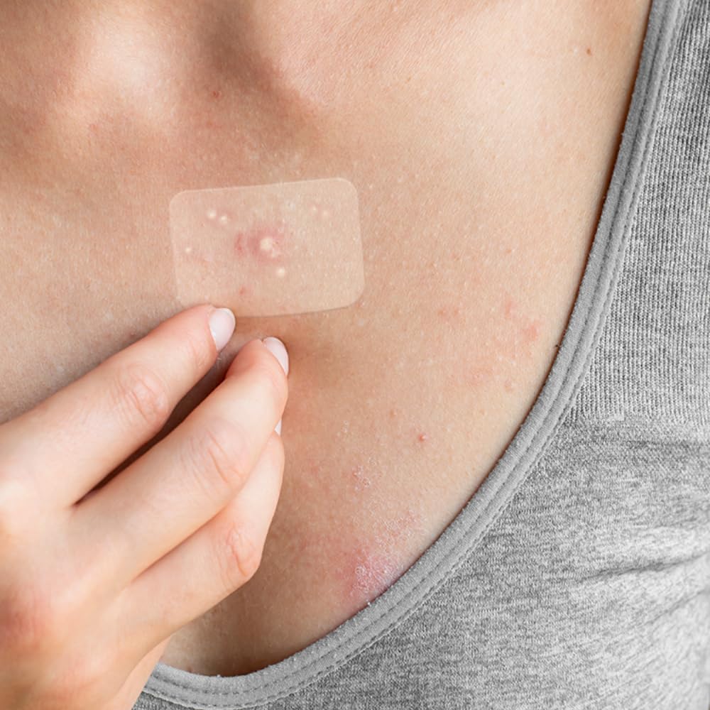 Truly Clear Target Patches For Face & Body - Hydrocolloid Acne Spot Stickers For Zits And Blemishes, Vegan, Cruelty-Free Acne So