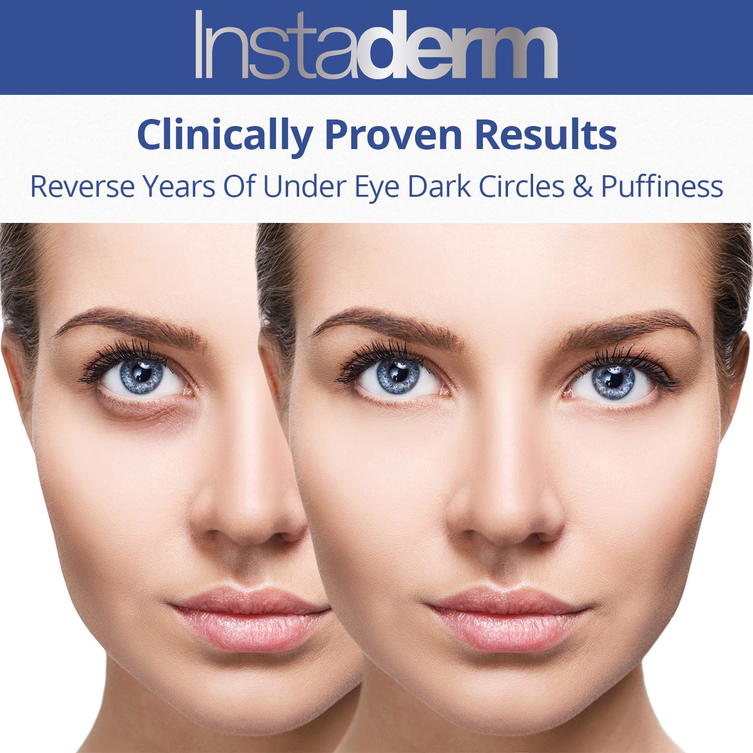 Instaderm Vitamin K Cream- Bruise Healing Formula With Arnica. Dark Spot Moisturizer For Bruising, Spider Veins & Broken Capilla
