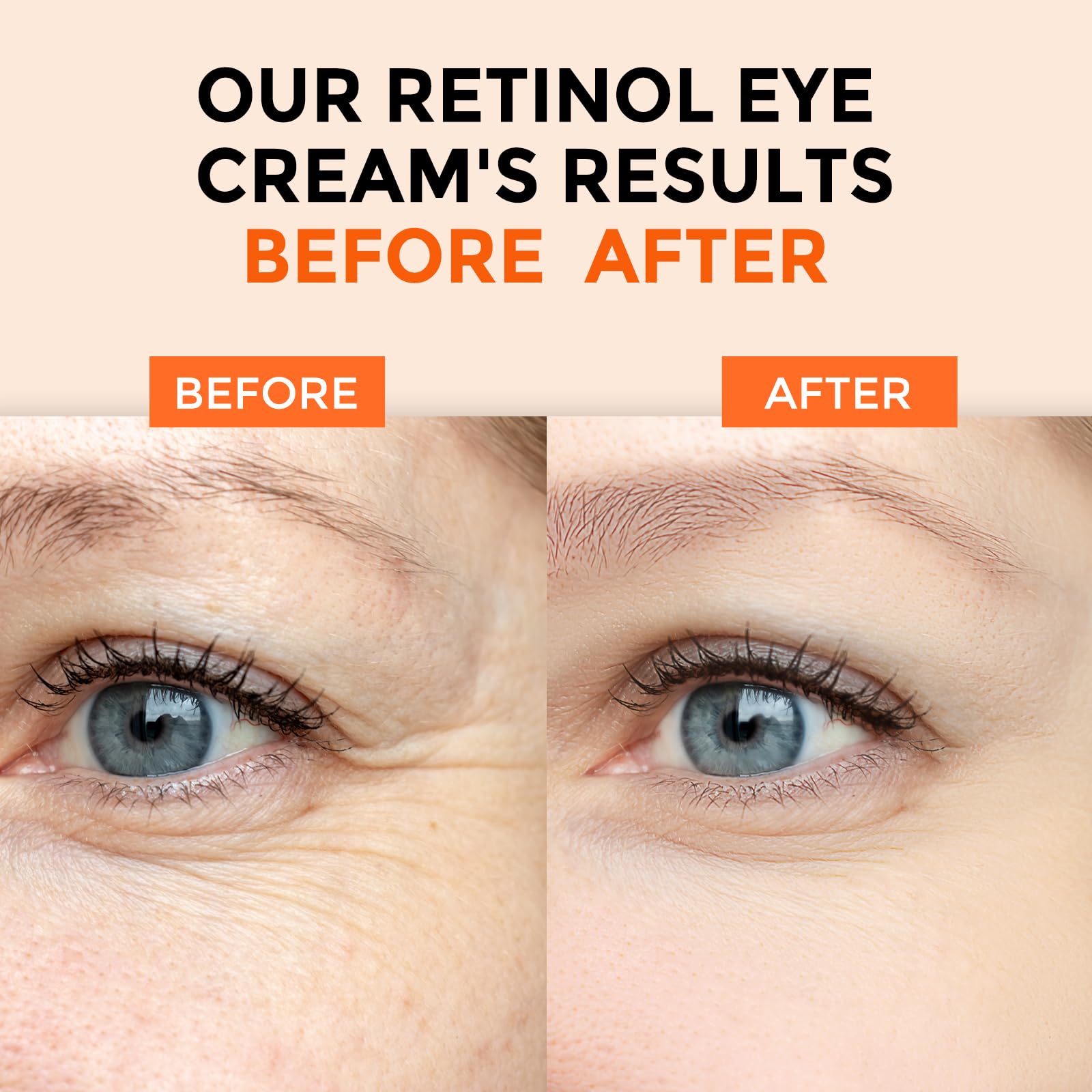 +1Herolabs Retinol Eye Cream For Dark Circles And Puffiness, Anti Aging Under Eye Cream With Hyaluronic Acid, Retinol & Collagen