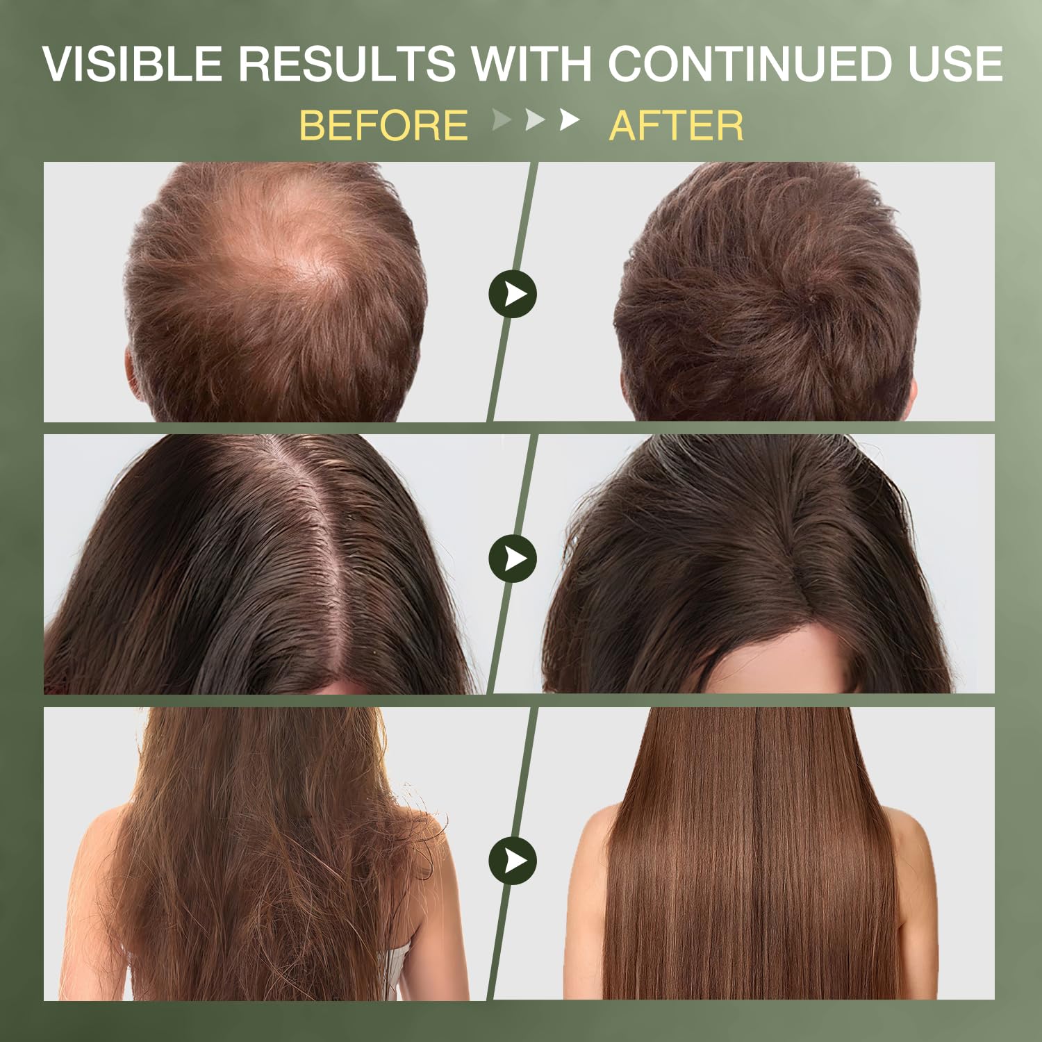 ulluxe Raw Batana Oil for Hair Growth - 100% Natural Unrefined & Organic, 4.23 Fl Oz, Enhances Thickness, Reduces Hair Loss, Brown
