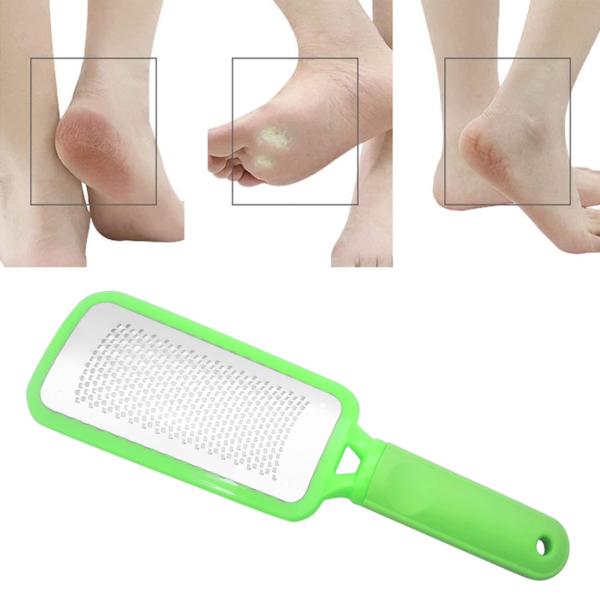 Professional Foot Files Kit 2Pcs,Foot Scrub Supplies,Stainless Steel Foot Files - Green