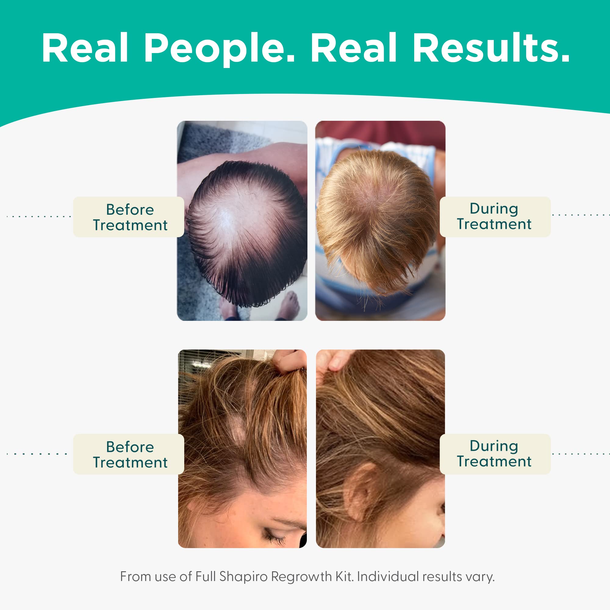 Hair Loss Conditioner | Dht Fighting Vegan Formula For Thinning Hair Developed By Dermatologists | Experience Healthier, Fuller
