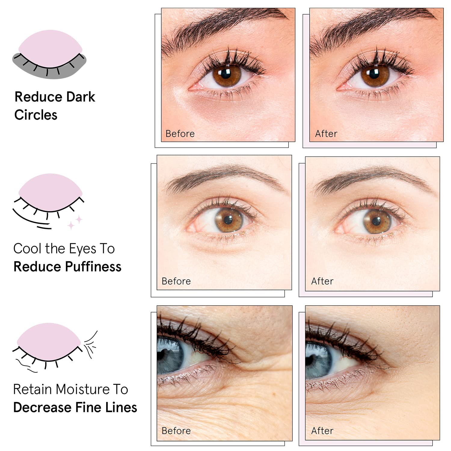 Under Eye Mask - Reduce Dark Circles, Puffy Eyes, Undereye Bags, Wrinkles - Gel Under Eye Patches, Vegan Cruelty-Free Self Care