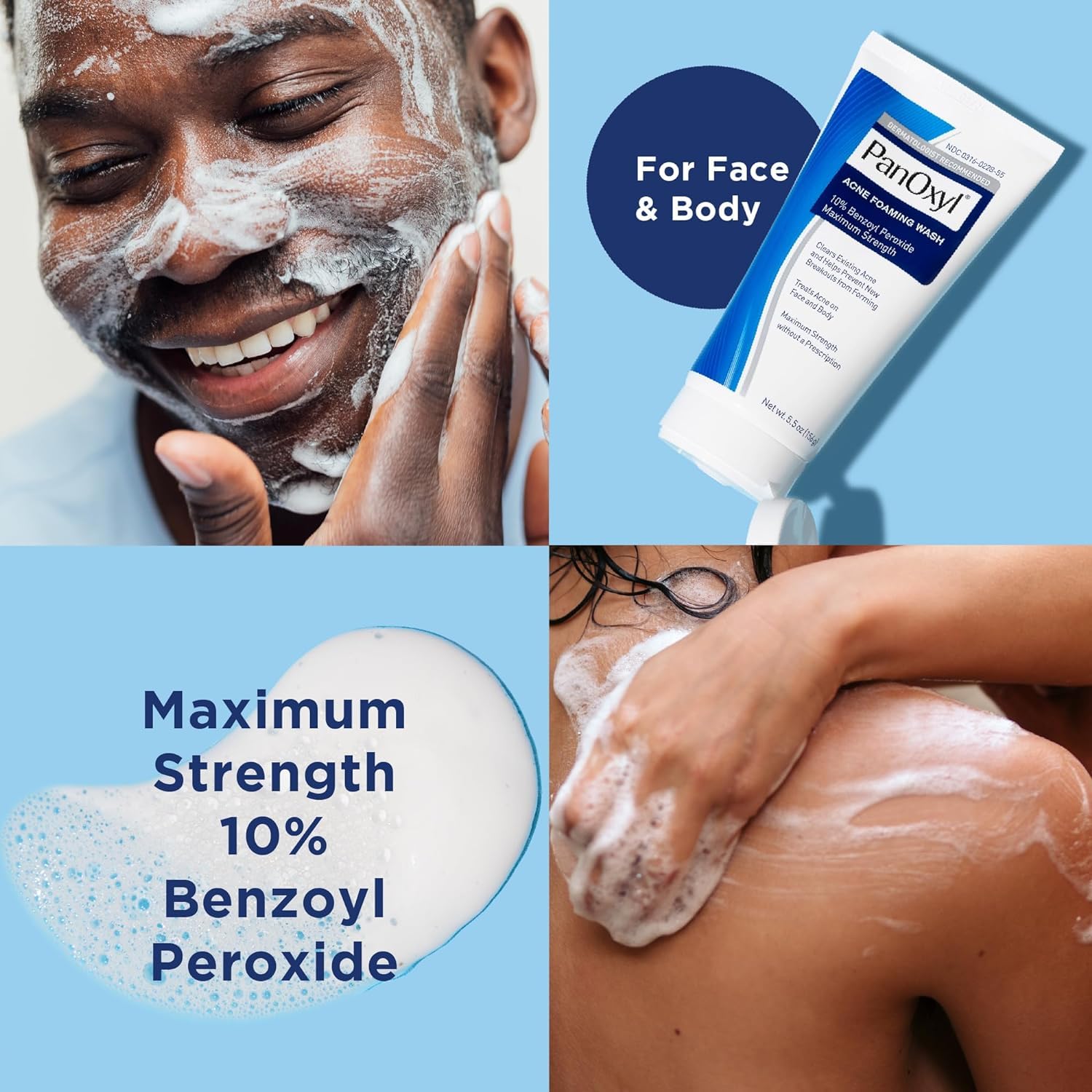 Panoxyl Acne Foaming Wash 10% Benzoyl Peroxide 5.5 Ounces
