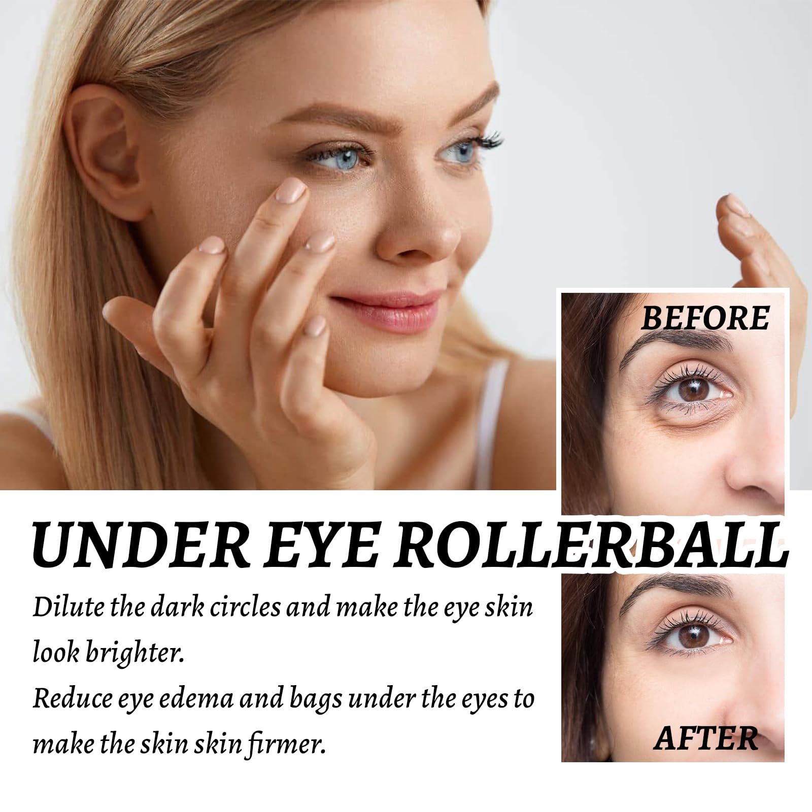 Eye Roller For Puffy Eyes, Castor Oil And Frankincense Eye Roller For Dark Circles, And Wrinkles, Anti Aging Eye Serum Cream, Gl