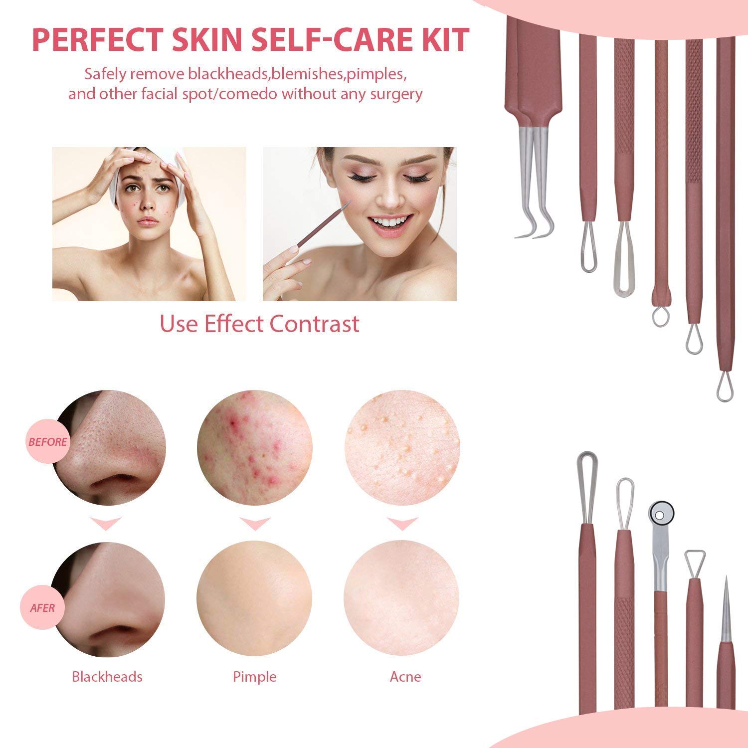 Jpnk Blackhead Remover Tool Comedones Extractor Acne Removal Kit For Blemish, Whitehead Popping, 6 Pcs Zit Removing For Nose Fac