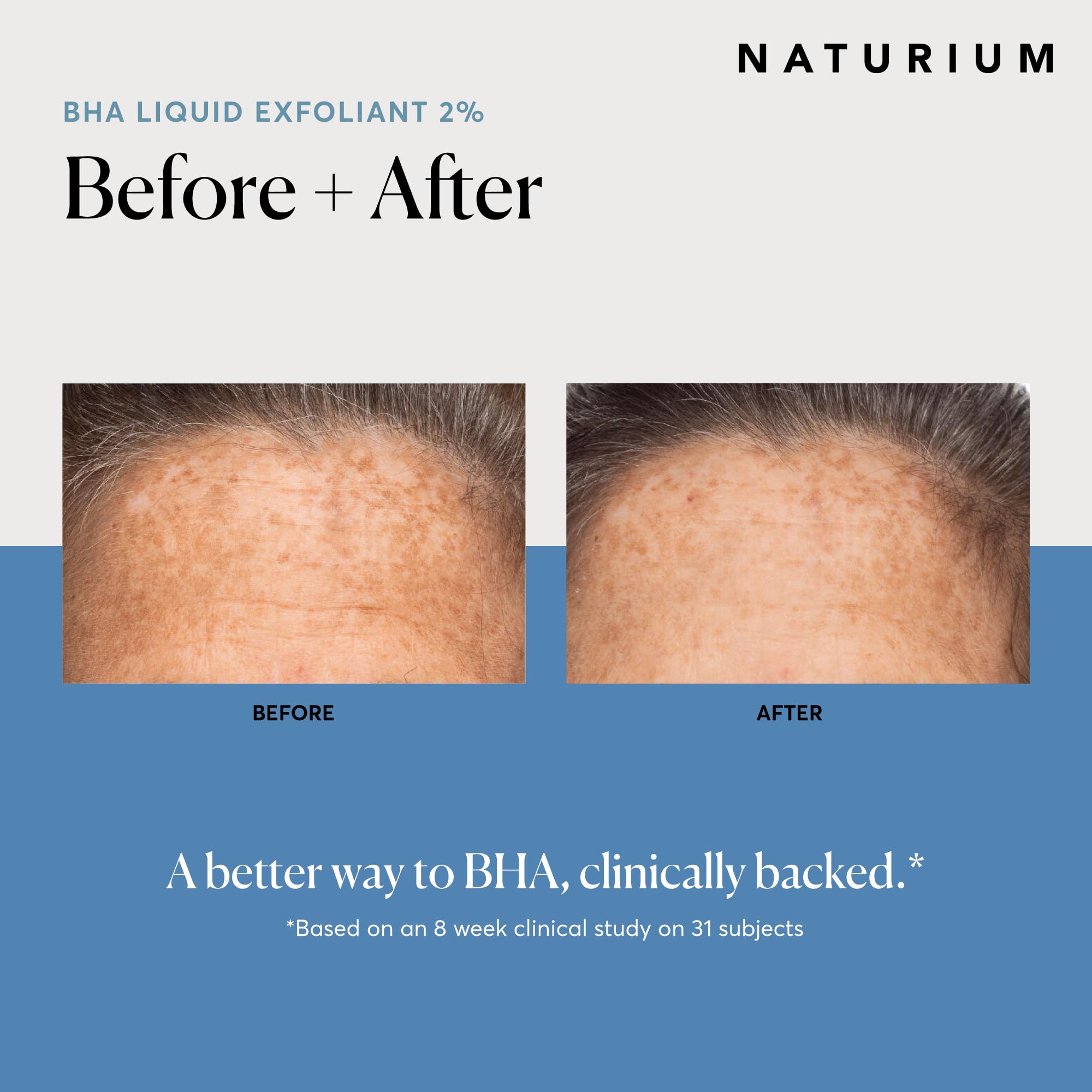 Naturium Bha Liquid Exfoliant 2%, Leave-On Face & Skin Care Exfoliating Pore Treatment, With Salicylic Acid & Bioactive Fruit Ac