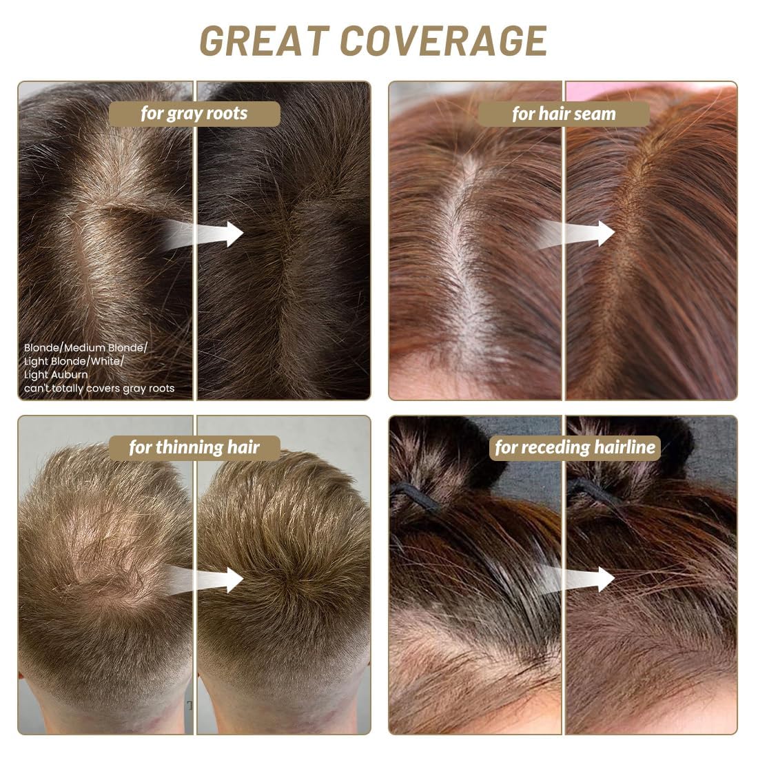 Sovoncare Instantly Hairline Powder-Maycheer Conceals Gray Hair Loss Shadow Coverage Magic Color Root Touch Up For Women & Men R