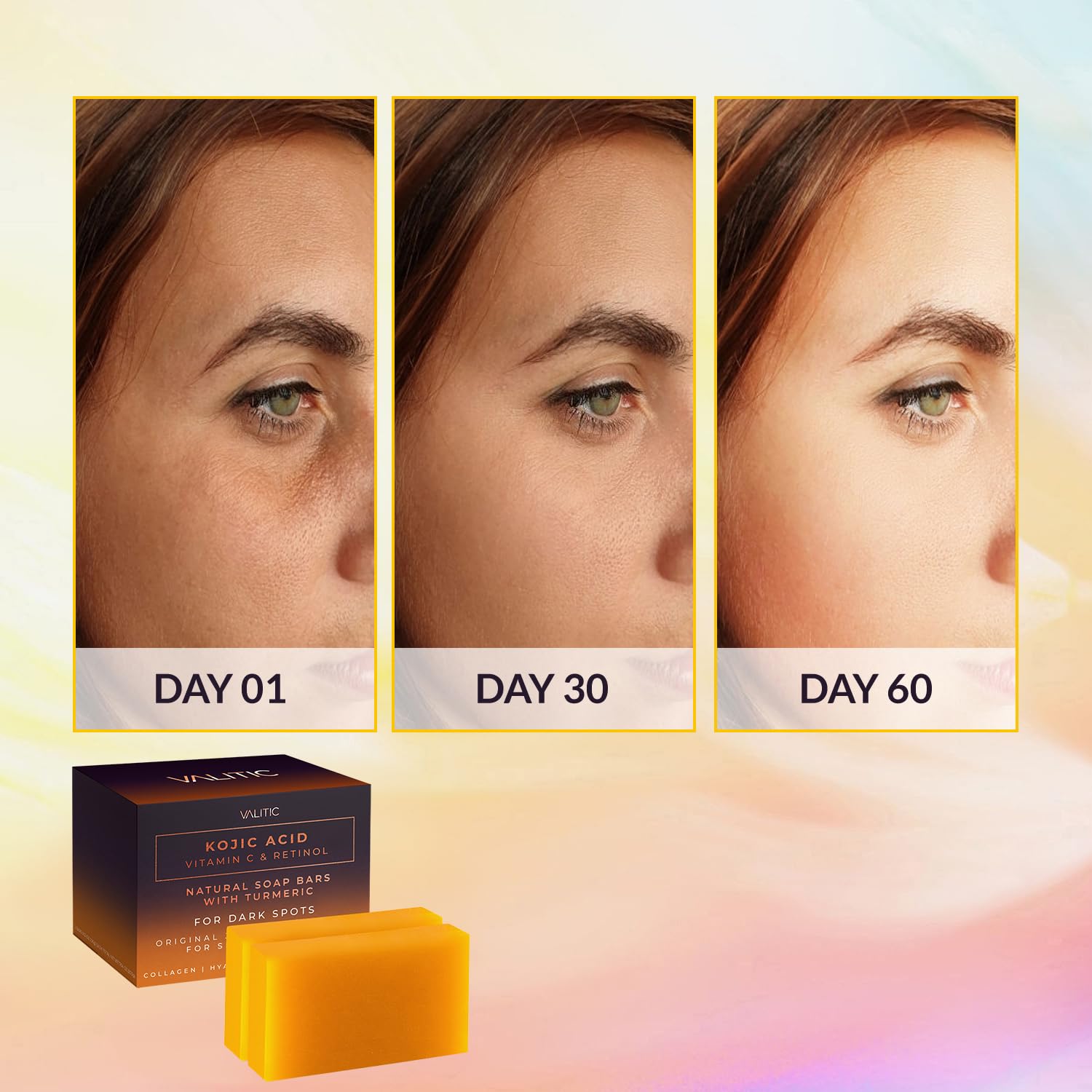 Valitic Kojic Acid Vitamin C And Retinol Soap Bars With Turmeric For Dark Spot - Original Japanese Complex Infused With Collagen