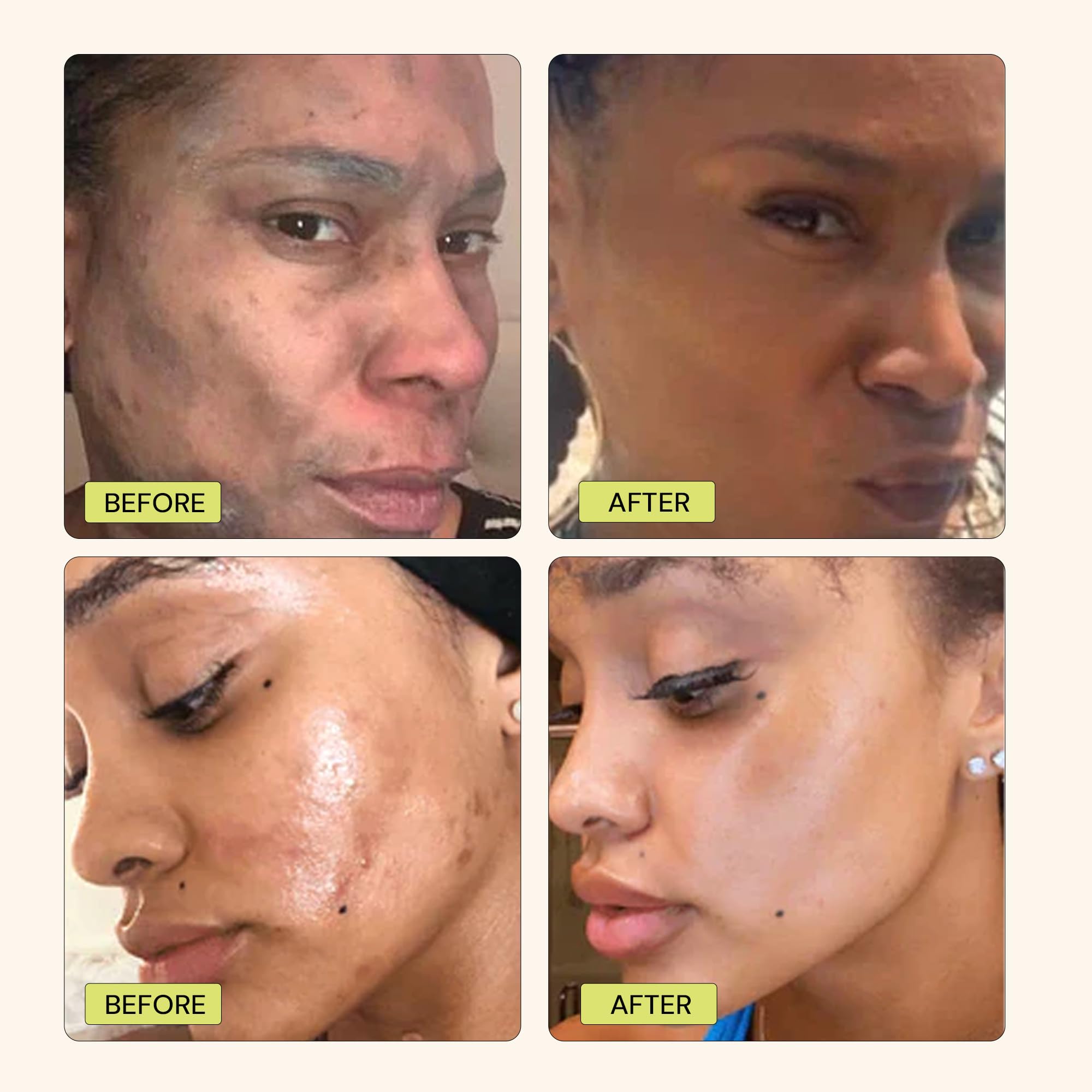 Gleamin Vitamin C Clay Mask - 10-Minutes For Dark Spots, Turmeric Face Mask Skin Care, Deep Cleansing Pores - Facial Improves Un