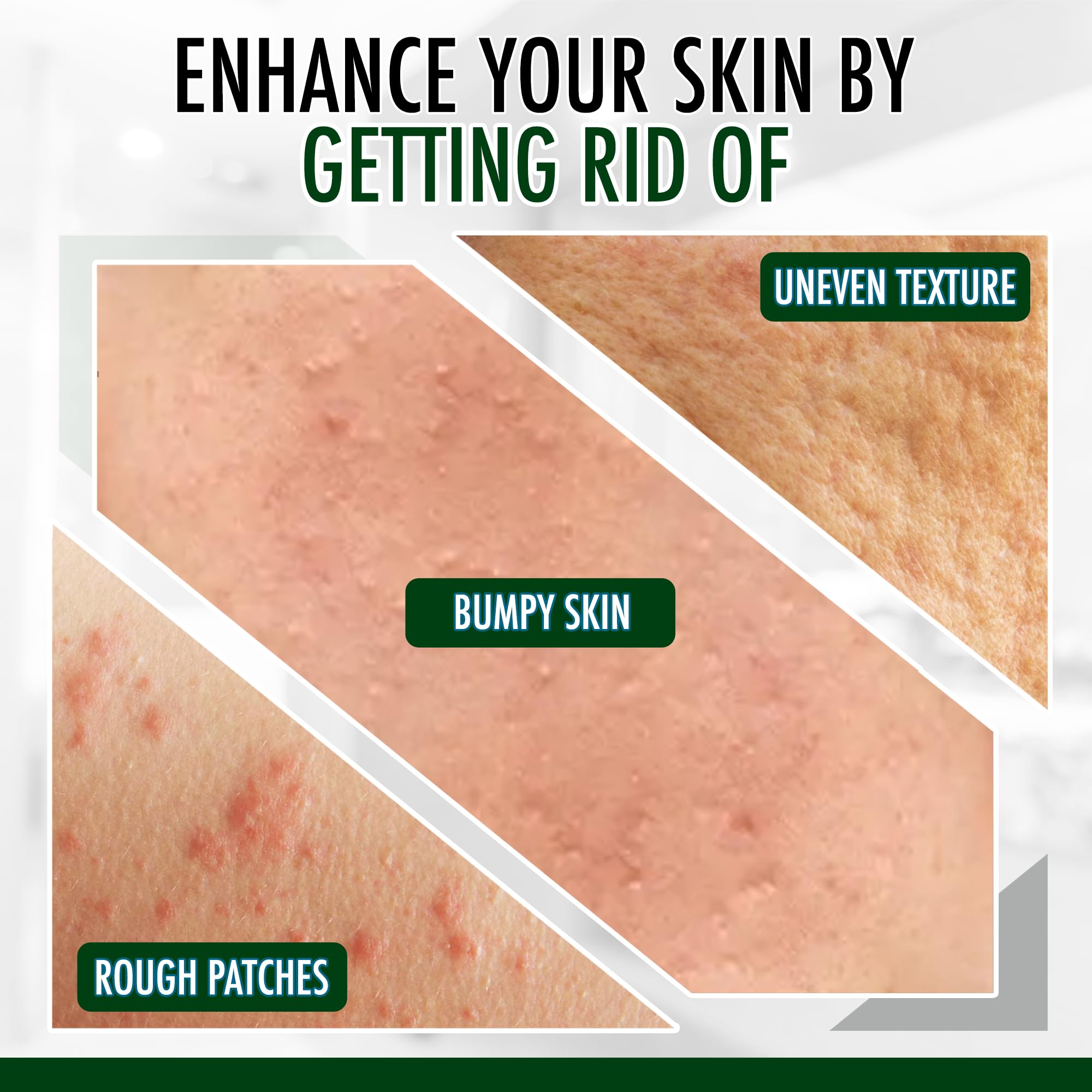 Gly Miracle Moisturizing Body Cream For Extremely Dry Skin, Non- Greasy Skin Humectant For Hands, Body & Feet, Body Lotion For E