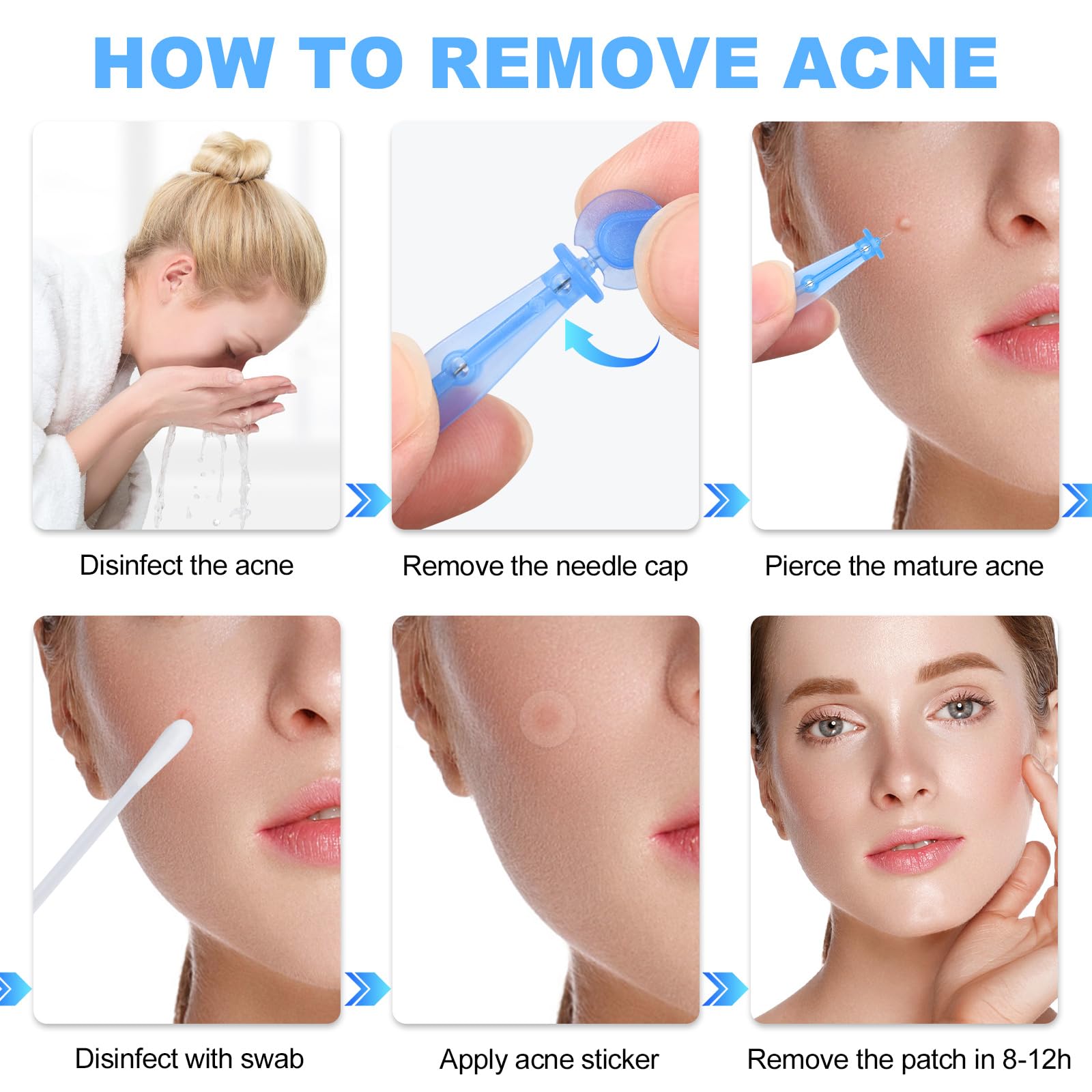 50Pcs Disposable Acne Needle And 72 Dots Pimple Stickers - Ultrafine Pimple Needle Pick Acne Tool Easily Pimple Popper Acne Need