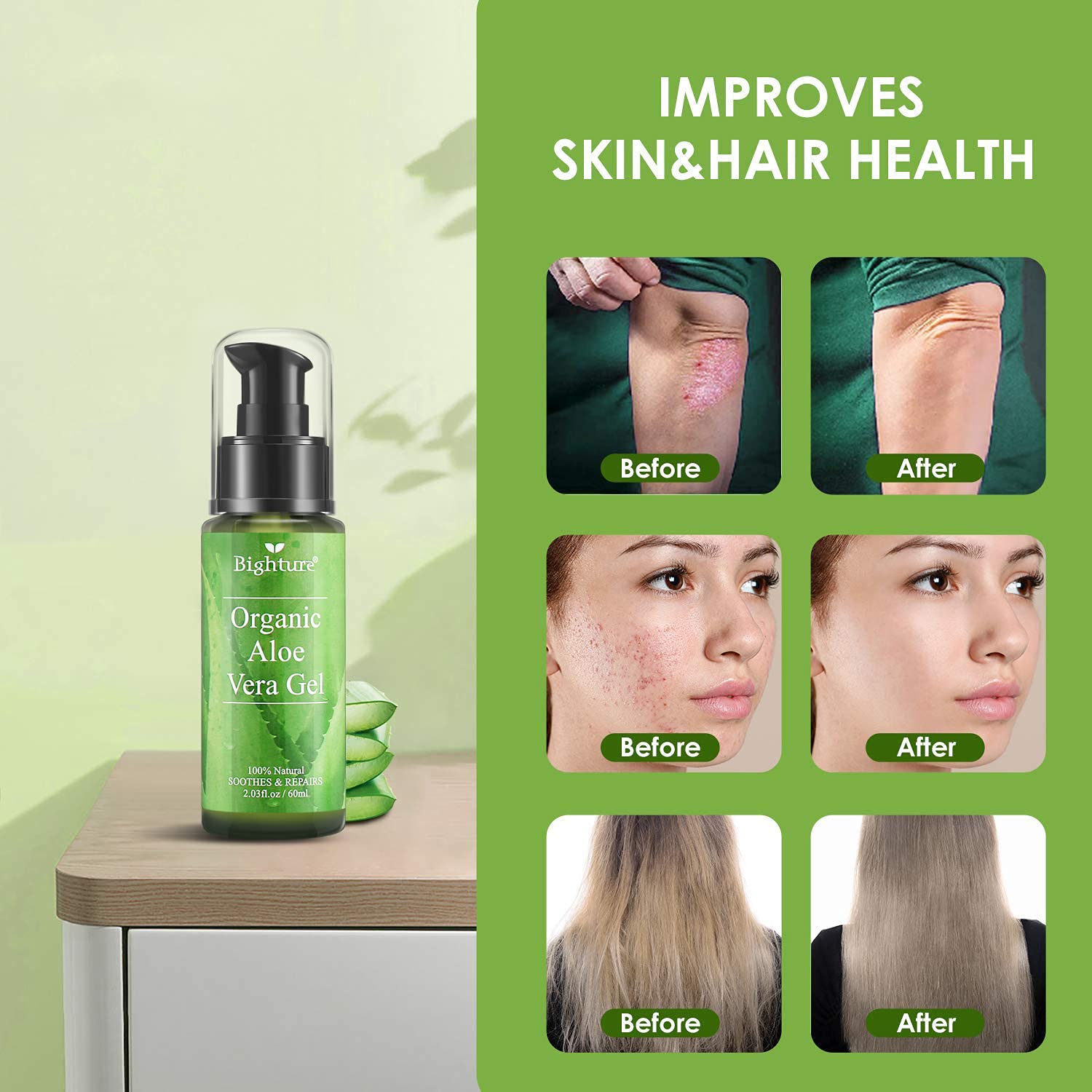 Bighture Organic Aloe Vera Gel, Aloe Vera Gel Extracted From Freshly Cut Pure Aloe Leaves, Skin Care For Deeply & Rapidly Soothi