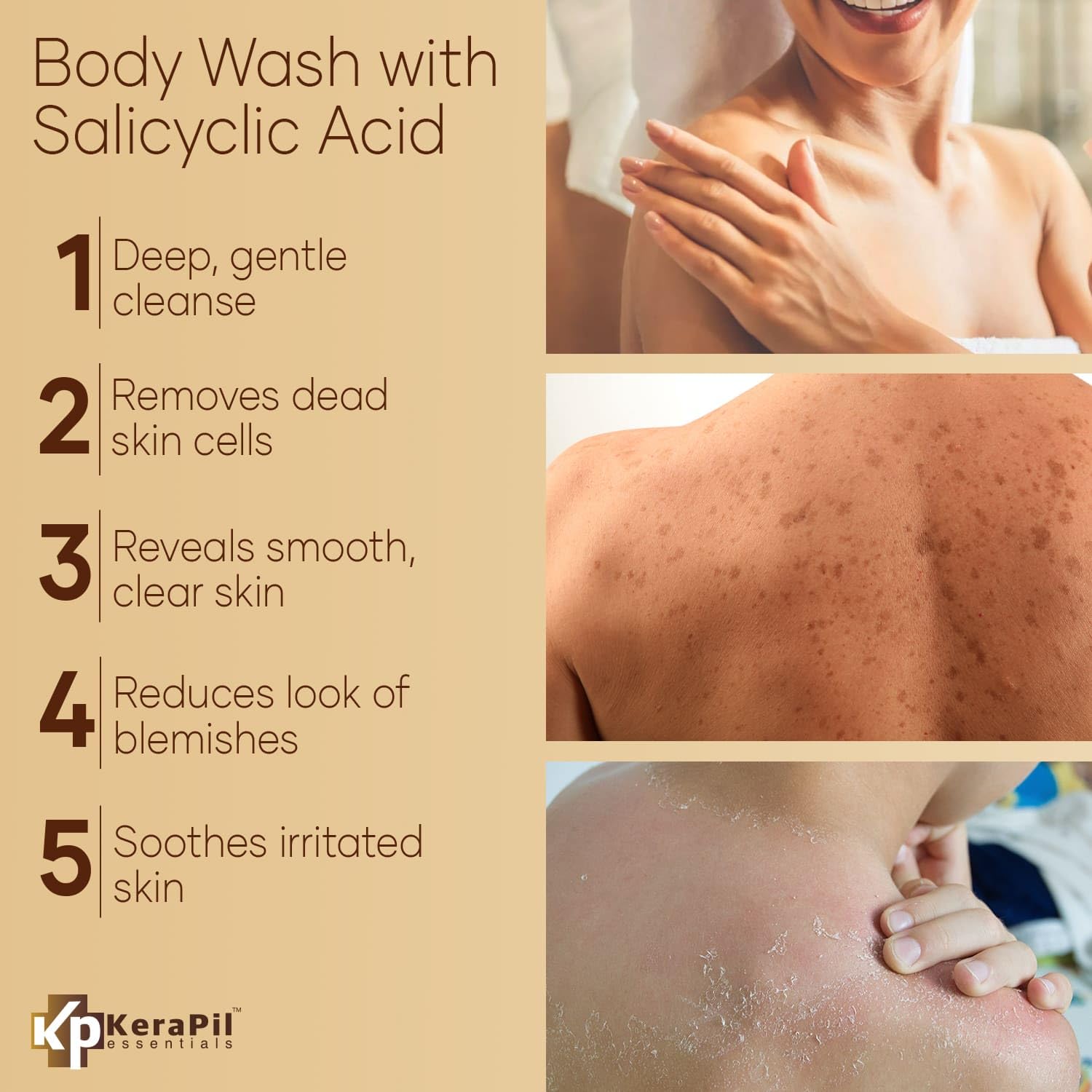 Kerapil Exfoliating Body Wash With Salicylic Acid - No Dry Out, Gentle Exfoliates Rough And Bumpy Skin, Body Acne Wash, Bha & Ah