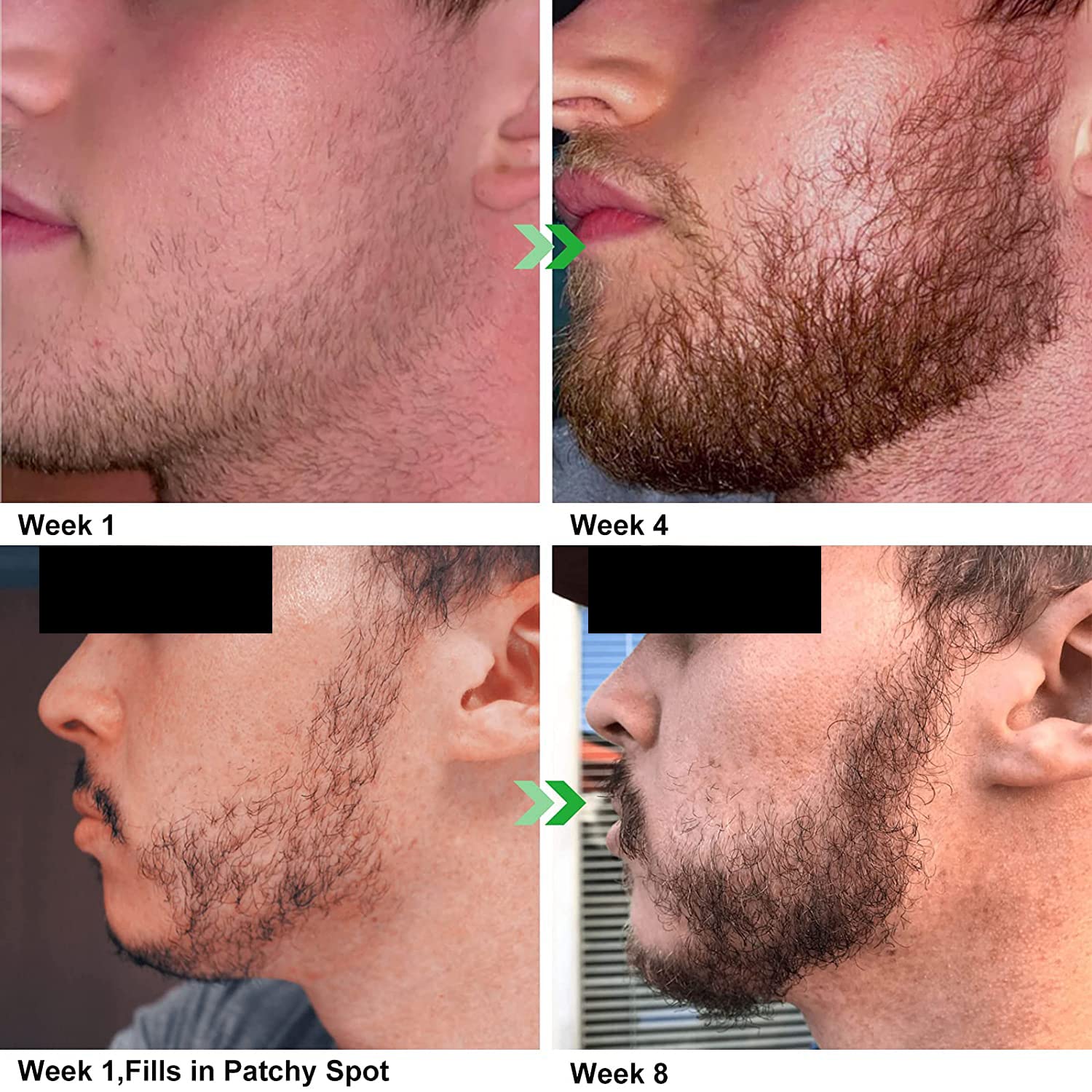 Unscented Beard Oil - 100% Natural, Organically Sourced, Non-Gmo, Facial Hair Hydrating & Conditioning Oil Blend - 32 Oz - Bulk