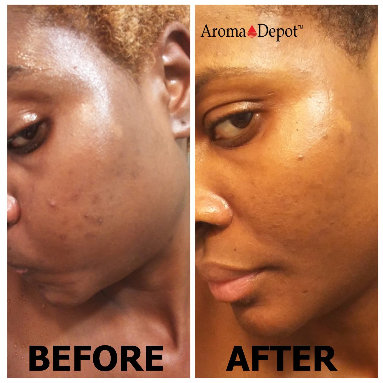 Aroma Depot 16 Oz /1 Lb Raw African Liquid Black Soap 100% Natural Soap For Acne, Eczema, Psoriasis, And Dry Skin Scar Removal F