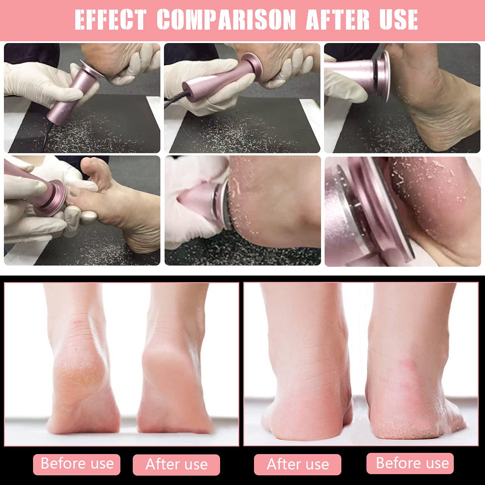 120 Pcs Replacement Sandpaper Discs For Electric Foot File Adjustable Speed Callus Remover Tool Sandpaper Pad Disks