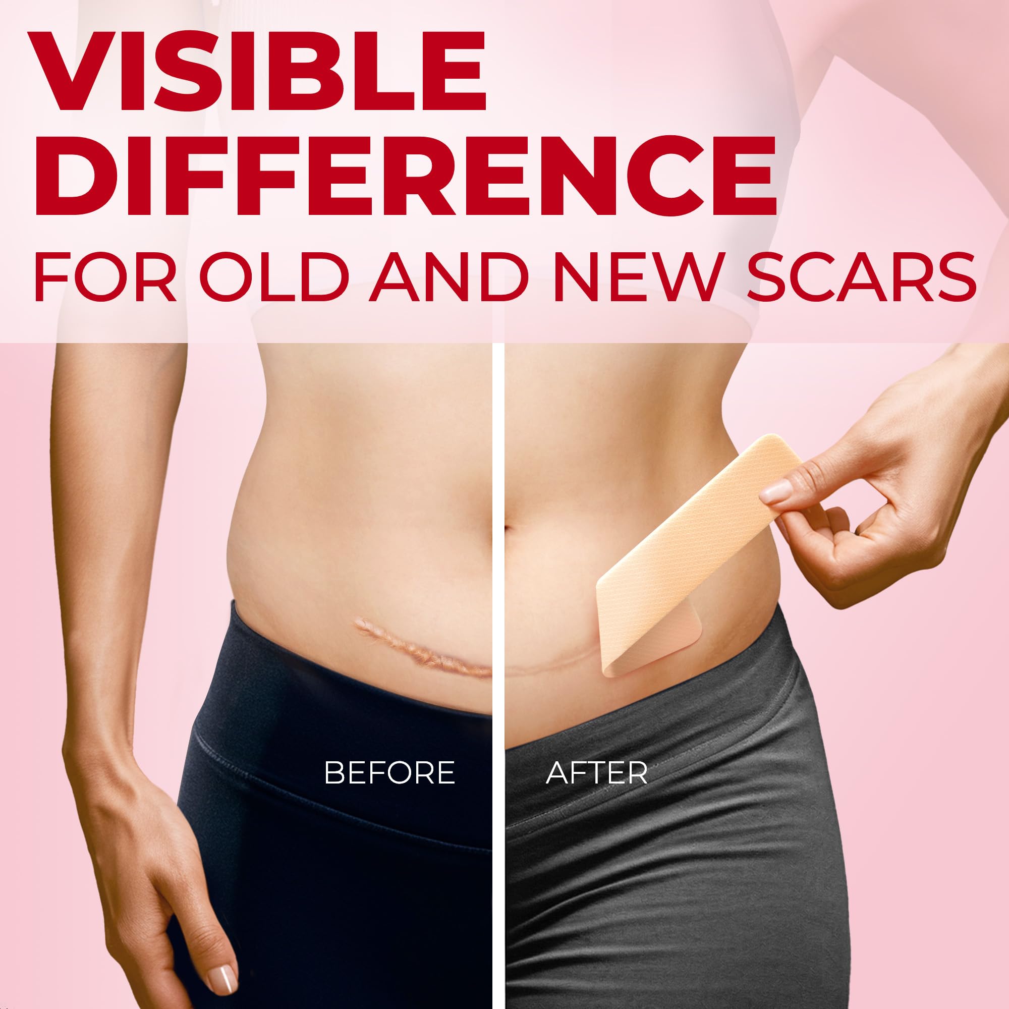 Medical Grade Silicone Scar Sheets - 4Pk (7   X1.6   ) - Visible Difference On C-Section Scars - Reusable Silicone Sheets For Sc