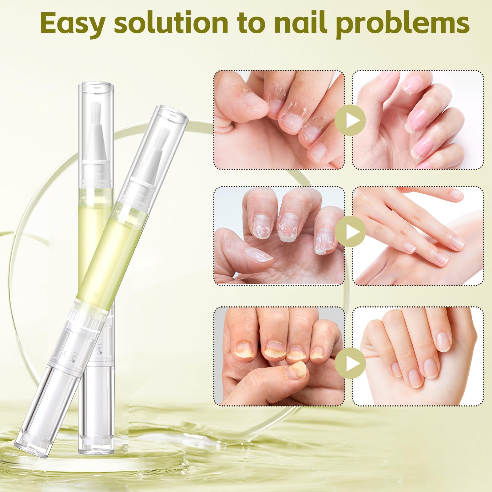 Radiant Nail Growth Gil, Radiant Nail Growth Oil Pen,Cuticle Oil For Nails,Nail Strengthener, For Moisturize Strengthen Nail Car