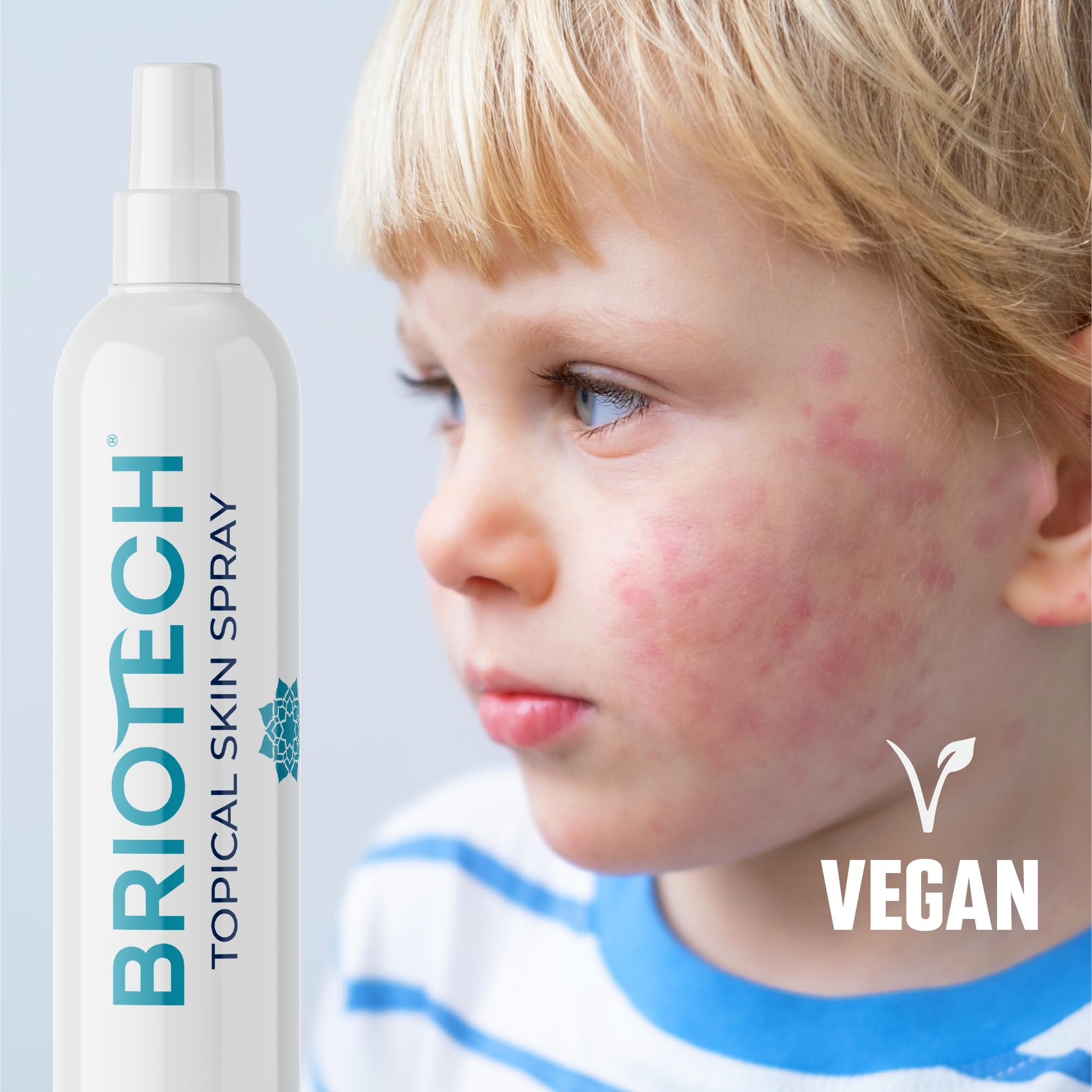 BRIOTECH Hypochlorous Acid Skin Spray for Body & Face, Eyelid Cleanser, Calms Redness, 4 oz, 2 Pack