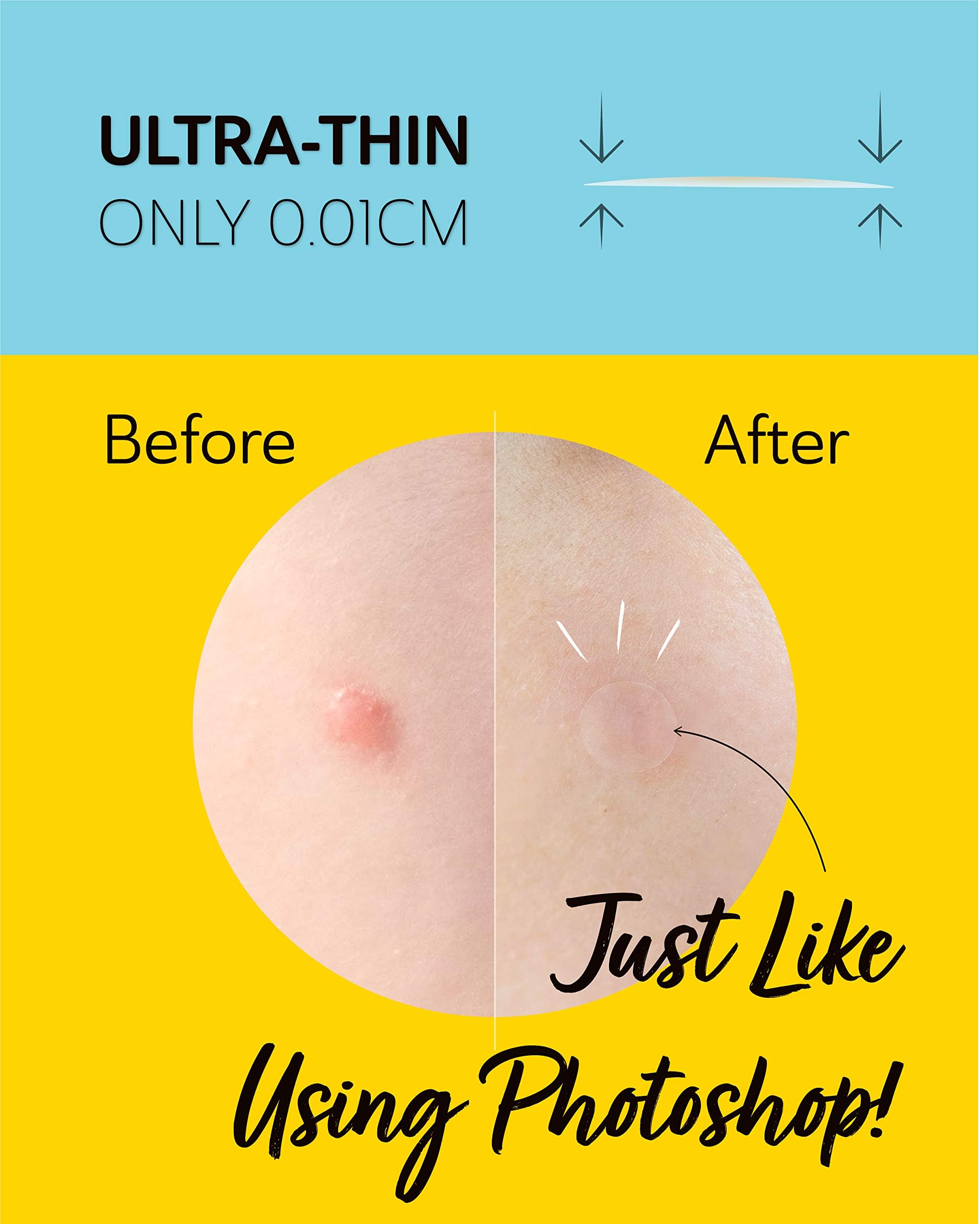 Derma Angel Ultra Invisible Acne Patches Pimple Patches Hydrocolloid Acne Patches Zit Patches Hydrocolloid Bandages Acne Spot Tr
