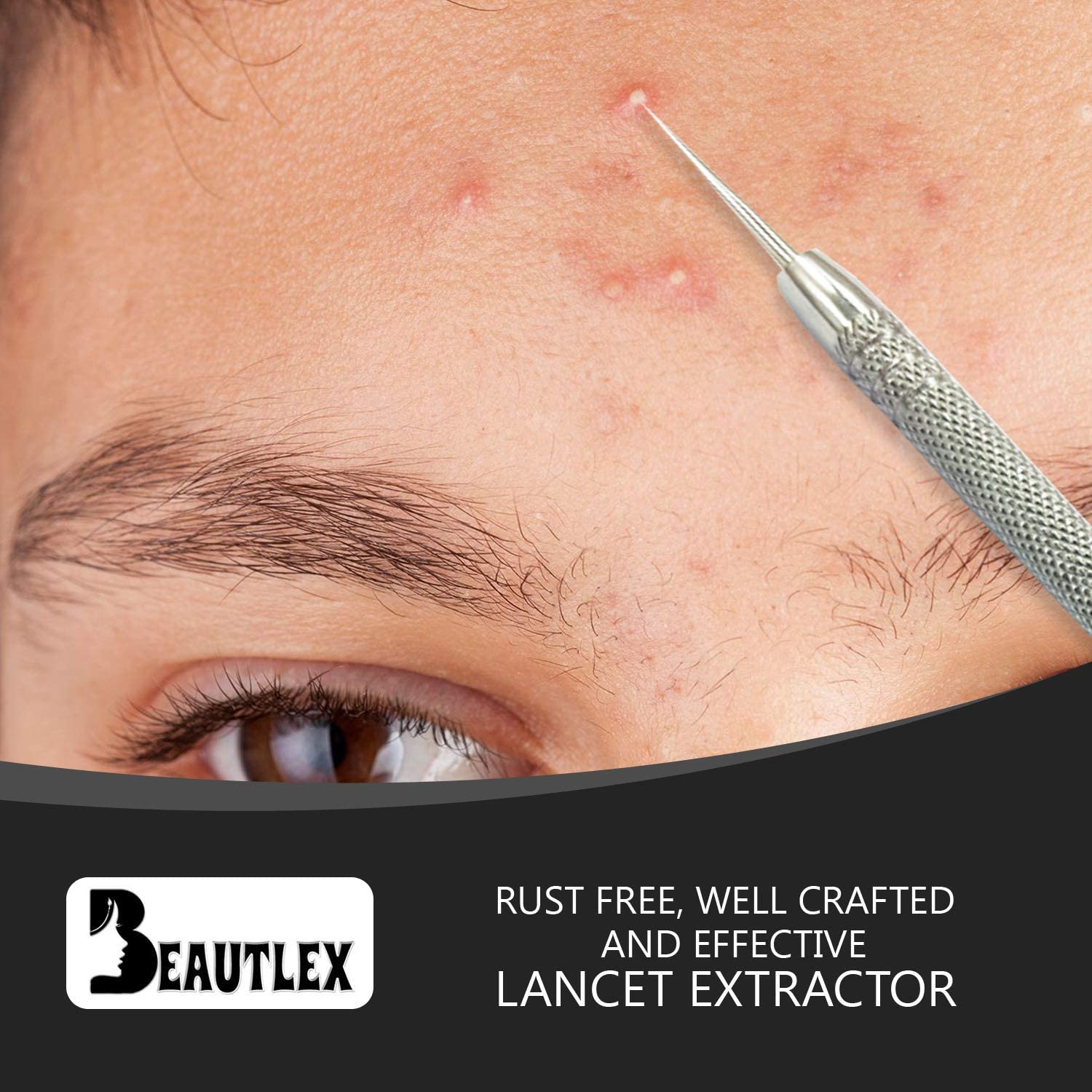Lancet For Facial Milia Remover And Whitehead Extractor. Double Ended Angled Circle Loop & Sharp Needle Pimple Popper Tool. Derm