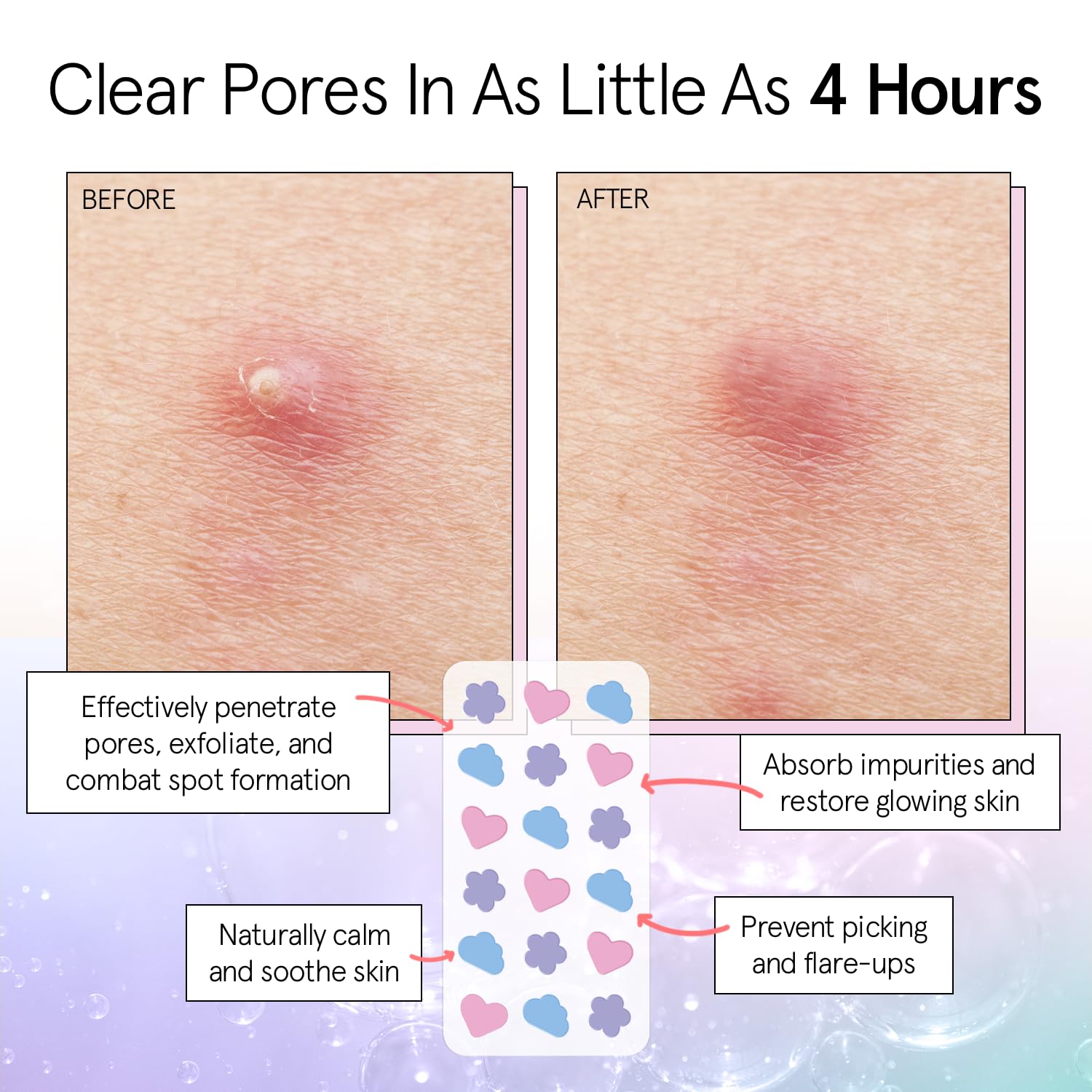 Grace & Stella Pimple Patches For Face (Multishape, 72 Count) - Hydrocolloid Acne Patches For Face - Dermatologist Tested, Vegan