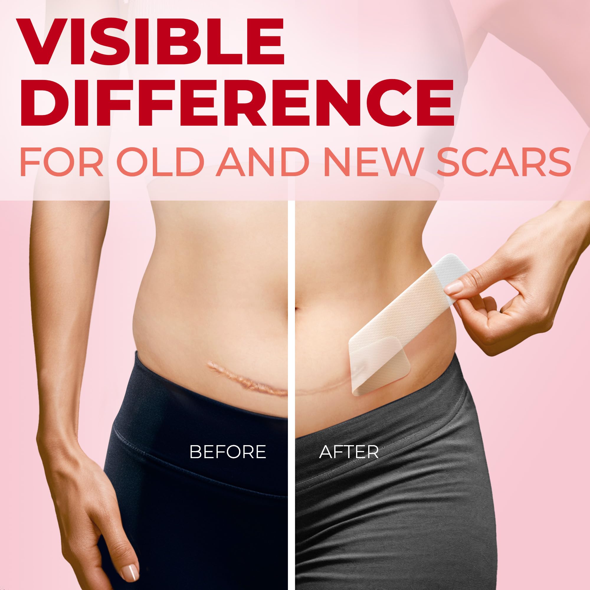 Medical Grade Silicone Scar Sheets - Transparent - 6Pk (7   X1.6   ) - Visible Difference On C-Section Scars - Reusable Silicone