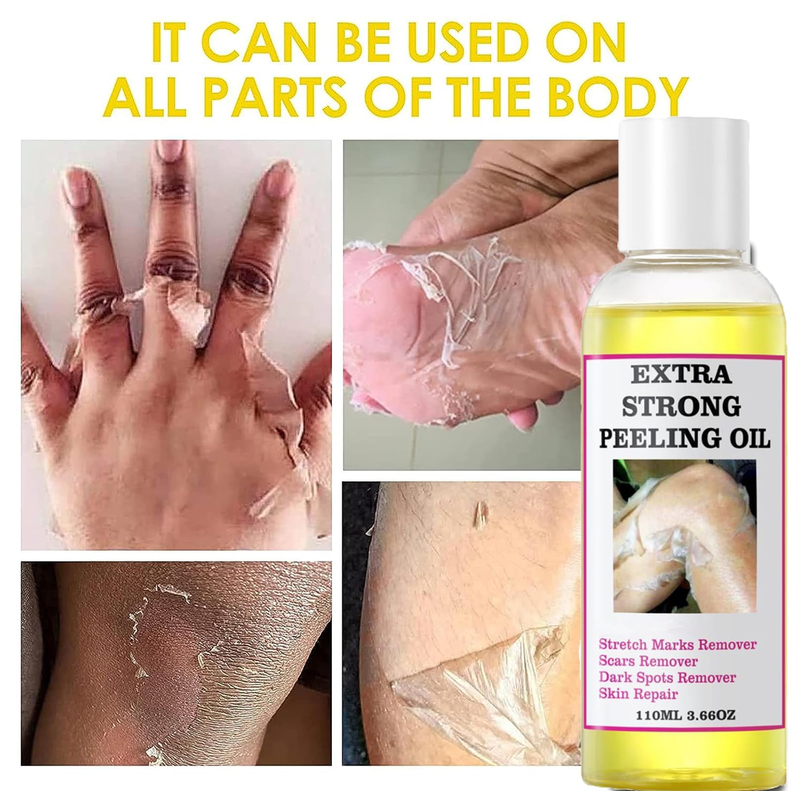 Generic Peeling Oil, Extra Strong Peeling Oil, Yellow Peeling Oil For Dark Skin, Exfoliating Peeling Solution For Body, Hand, Fe