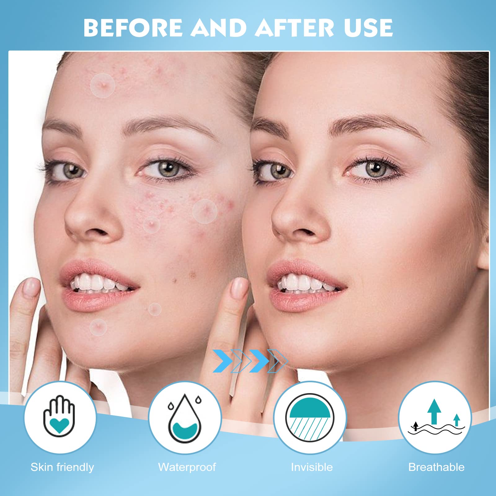 Soonuly Pimple Patches For Face - 108 Hydrocolloid Acne Pimple Patches Salicylic Acid With Tea Tree Oil For Zit Blemish Spot Cov