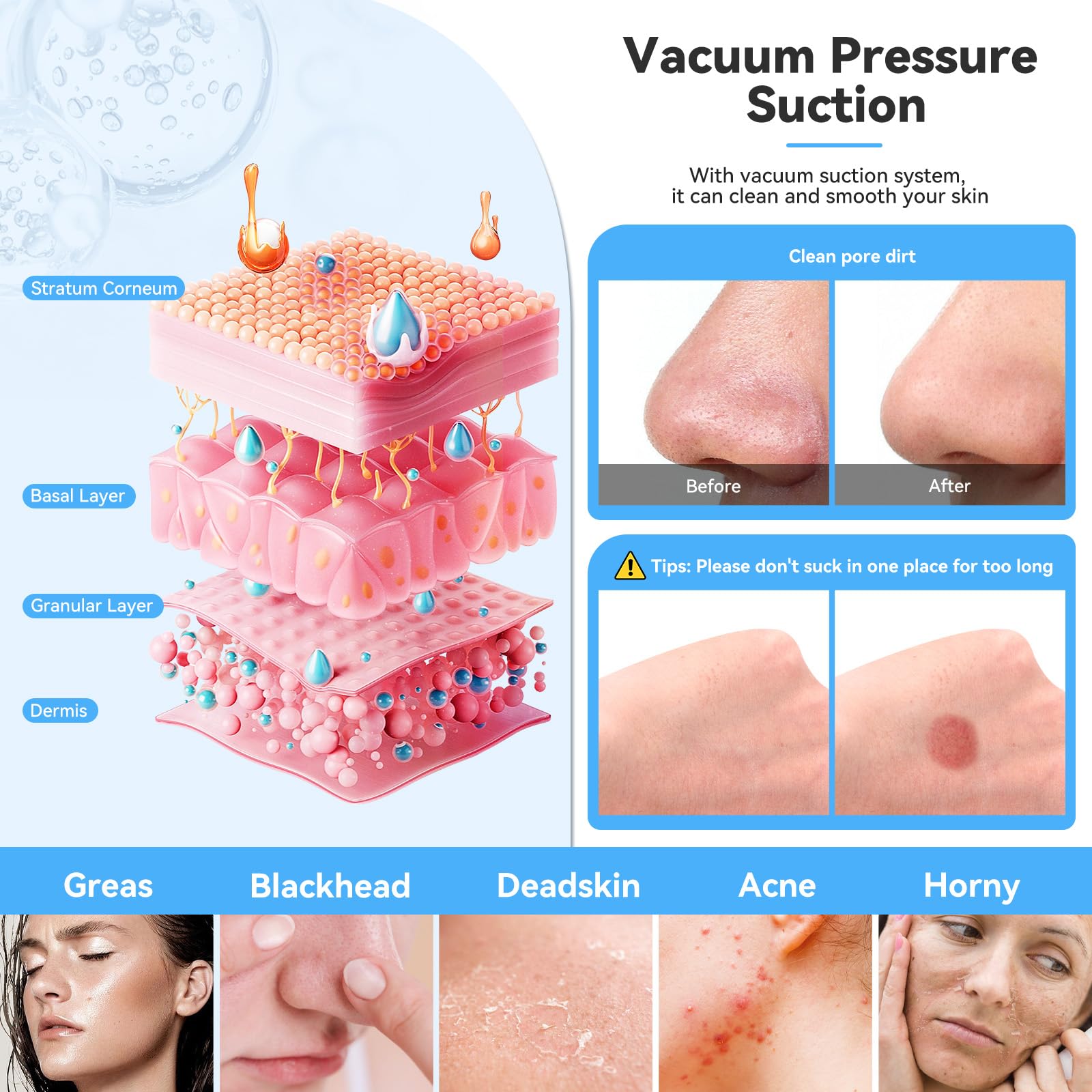Upgraded Diamond Micro-Dermabrasion Facial Machine, Professional Facial Deep Cleasing Tool, Home Use Facial Skin Care Equipment